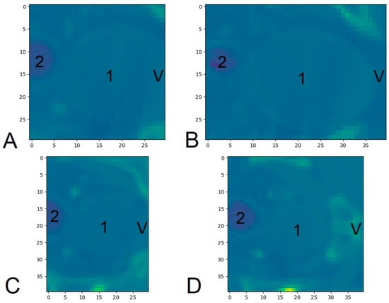 Cancers 17 01575 g0a3