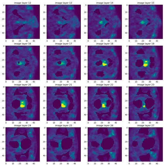 Cancers 17 01575 g0a4