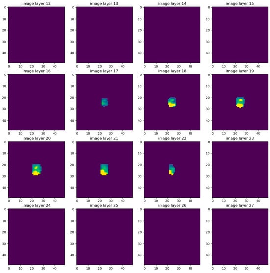 Cancers 17 01575 g0a5