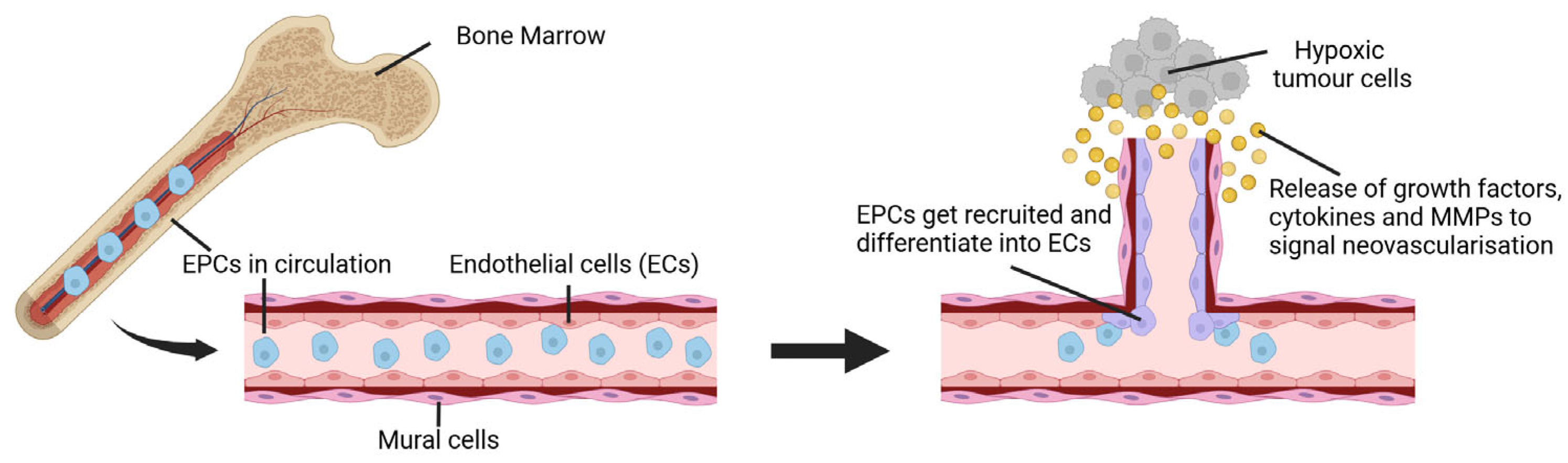 Cancers 17 01675 g004