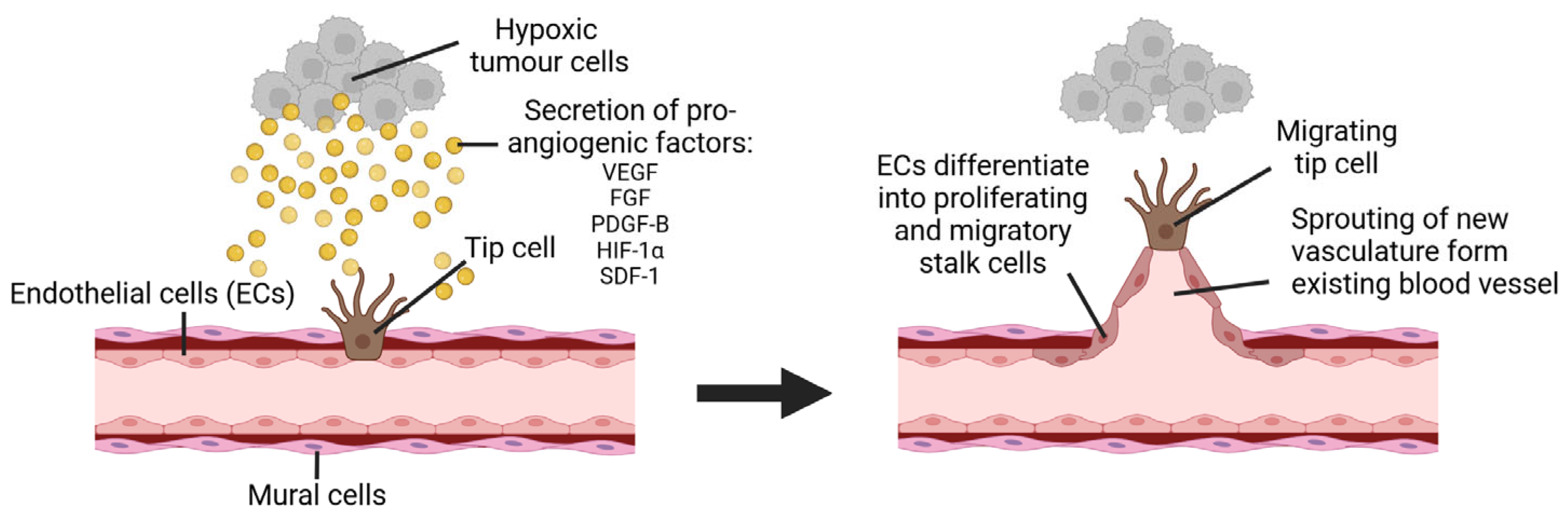 Cancers 17 01675 g005