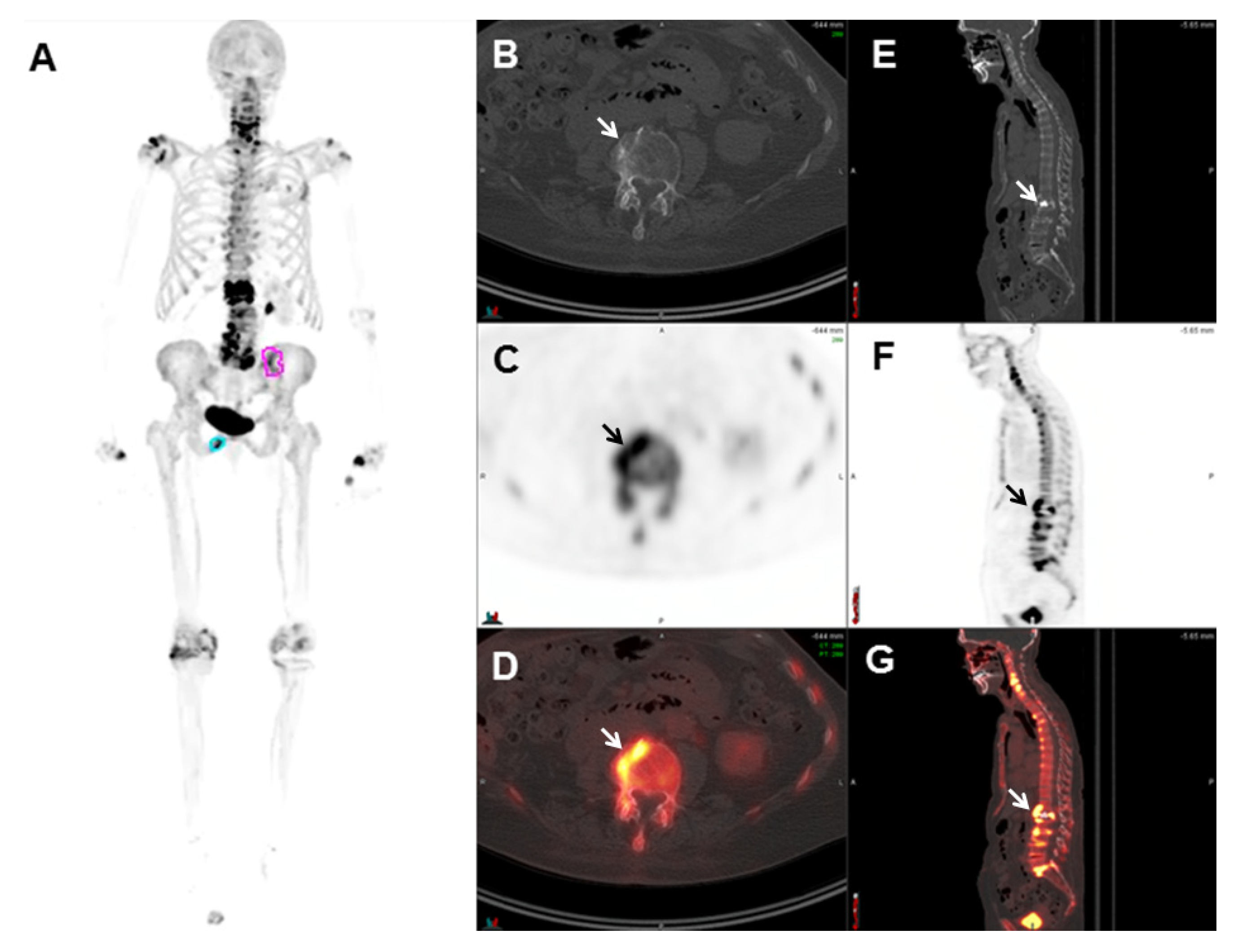 Cancers 17 01723 g001