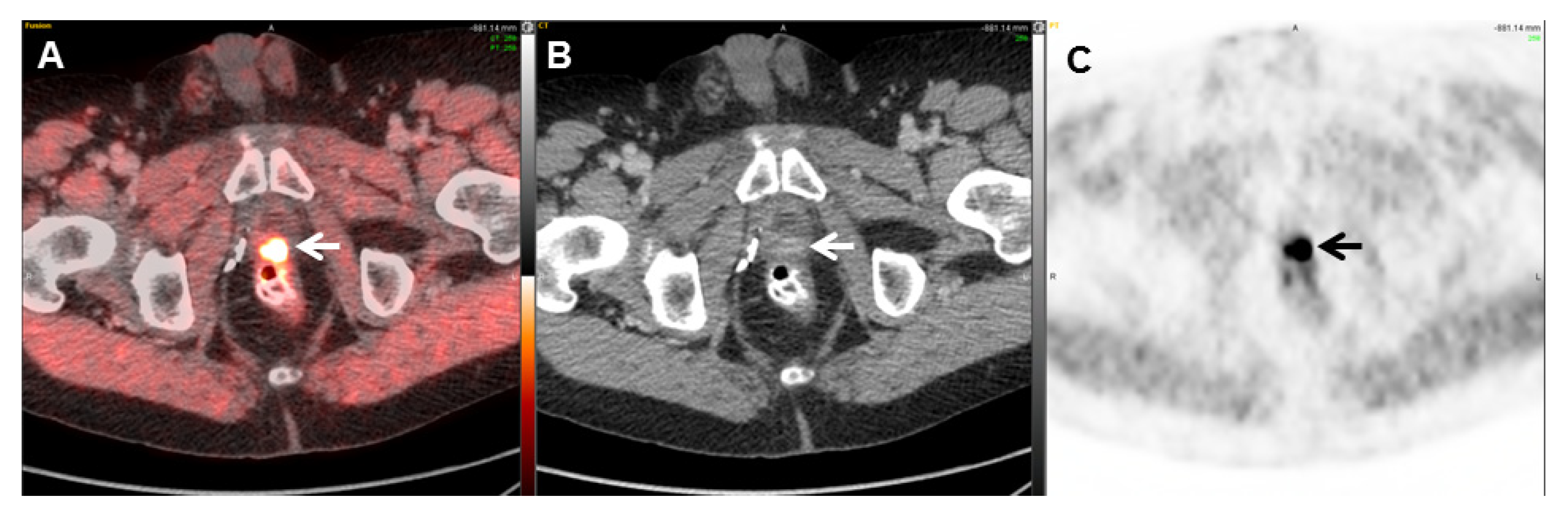 Cancers 17 01723 g002