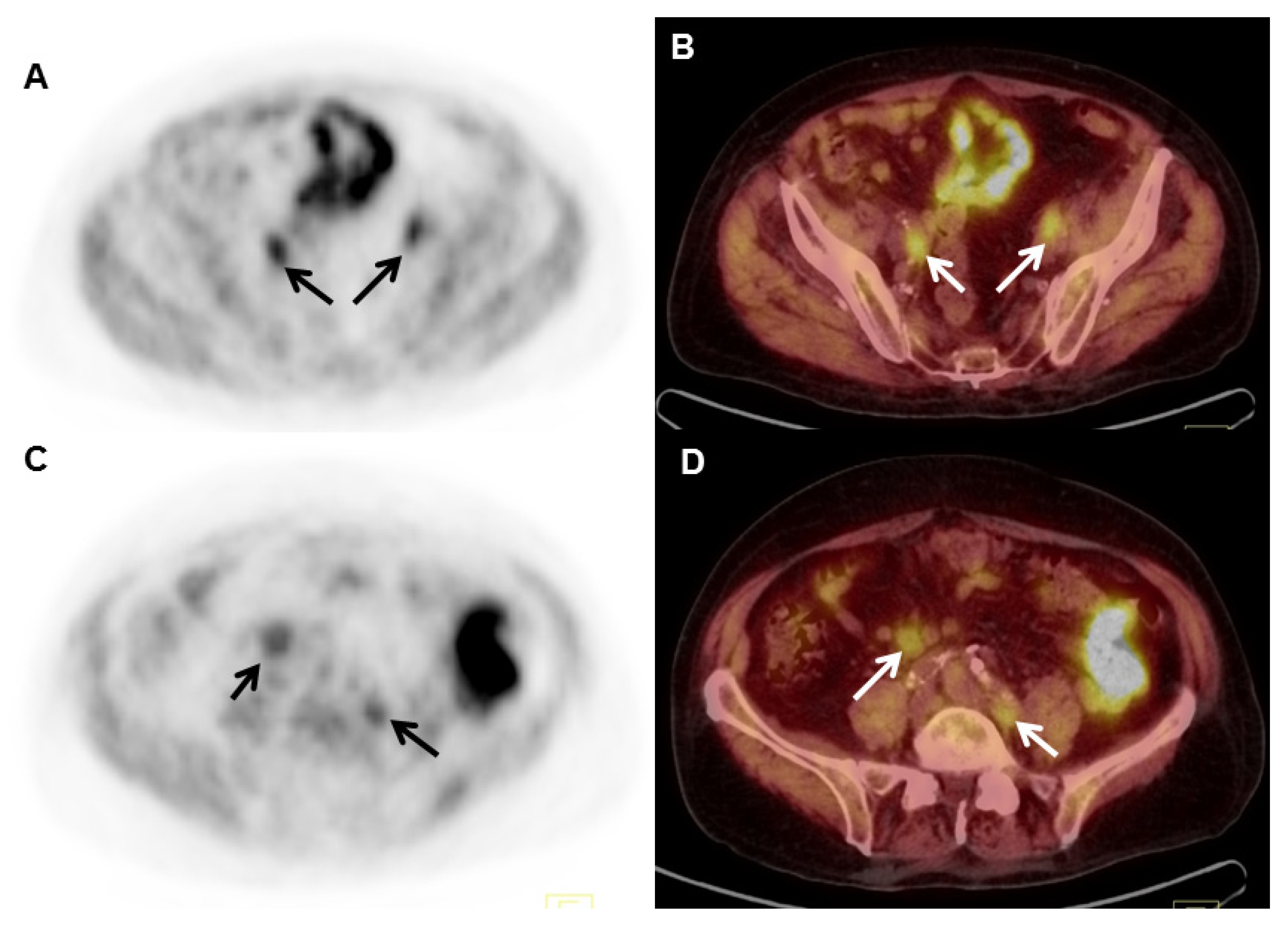 Cancers 17 01723 g003