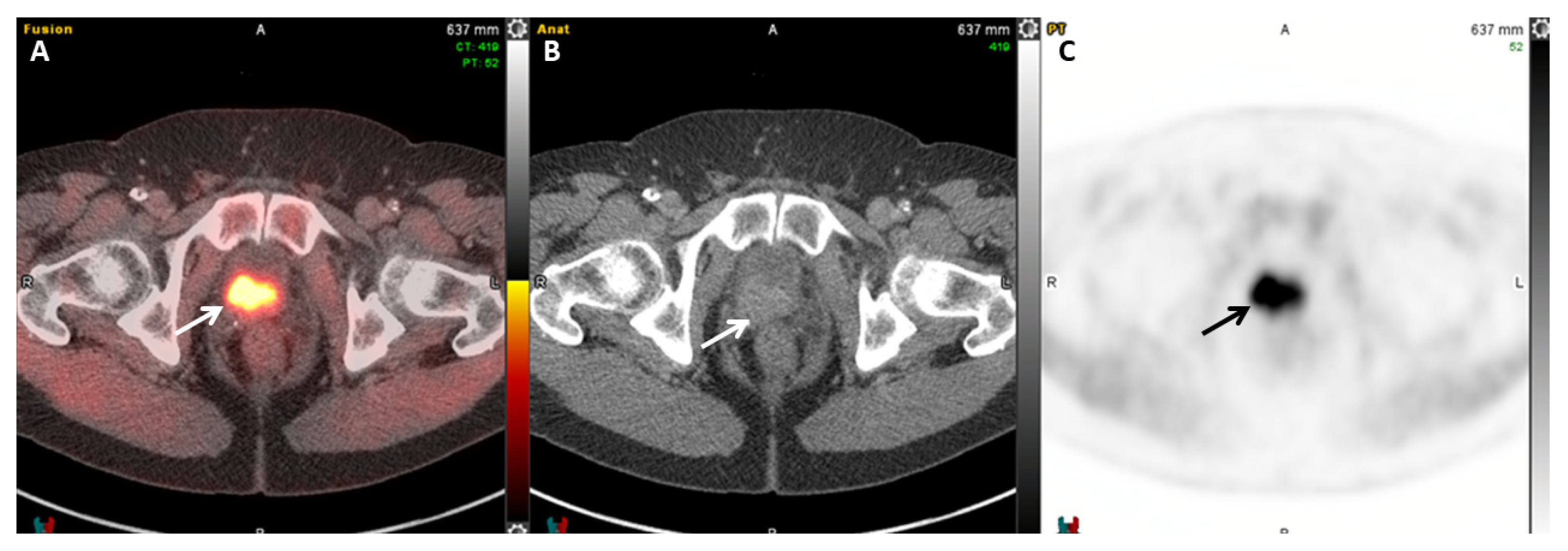 Cancers 17 01723 g004