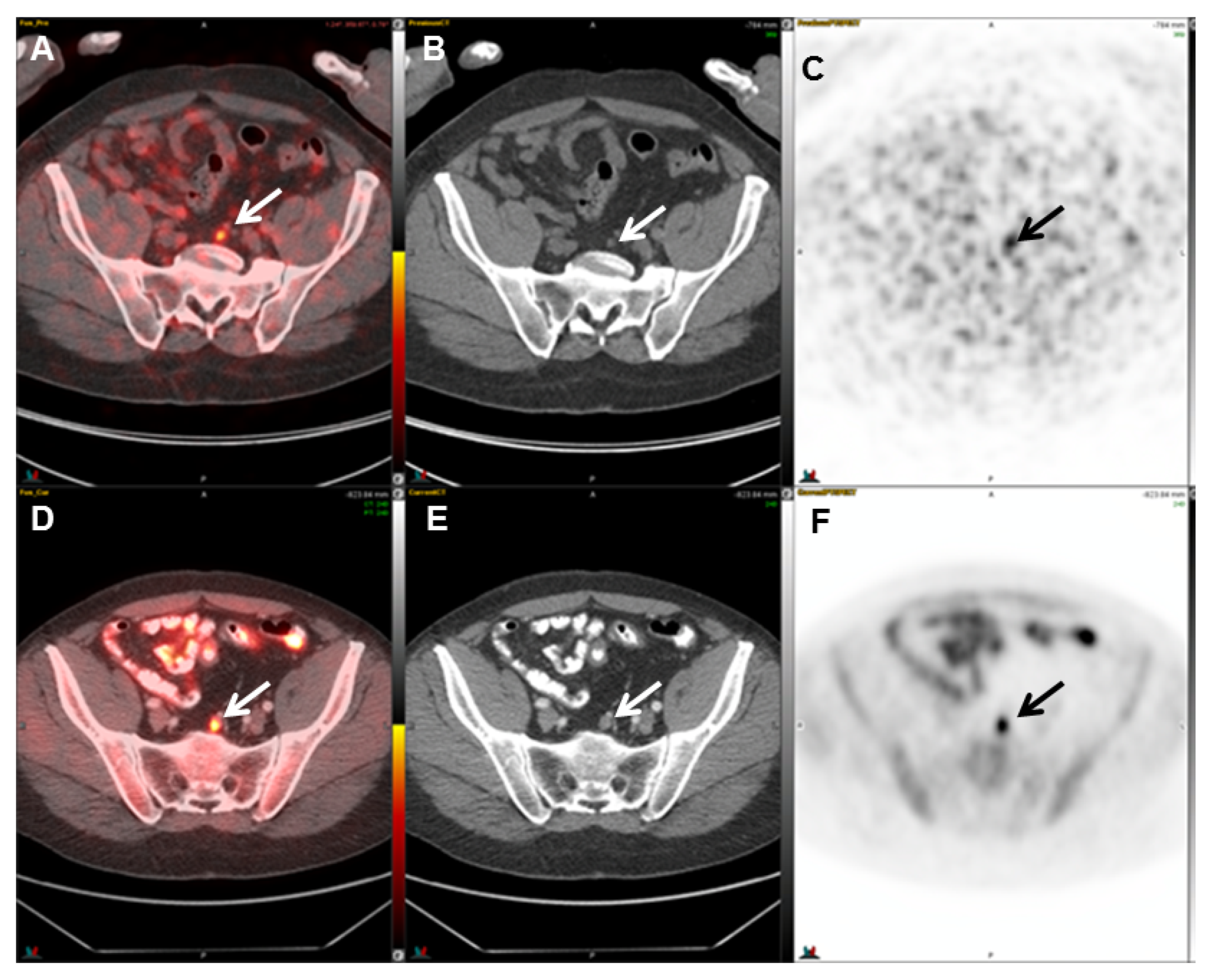 Cancers 17 01723 g005