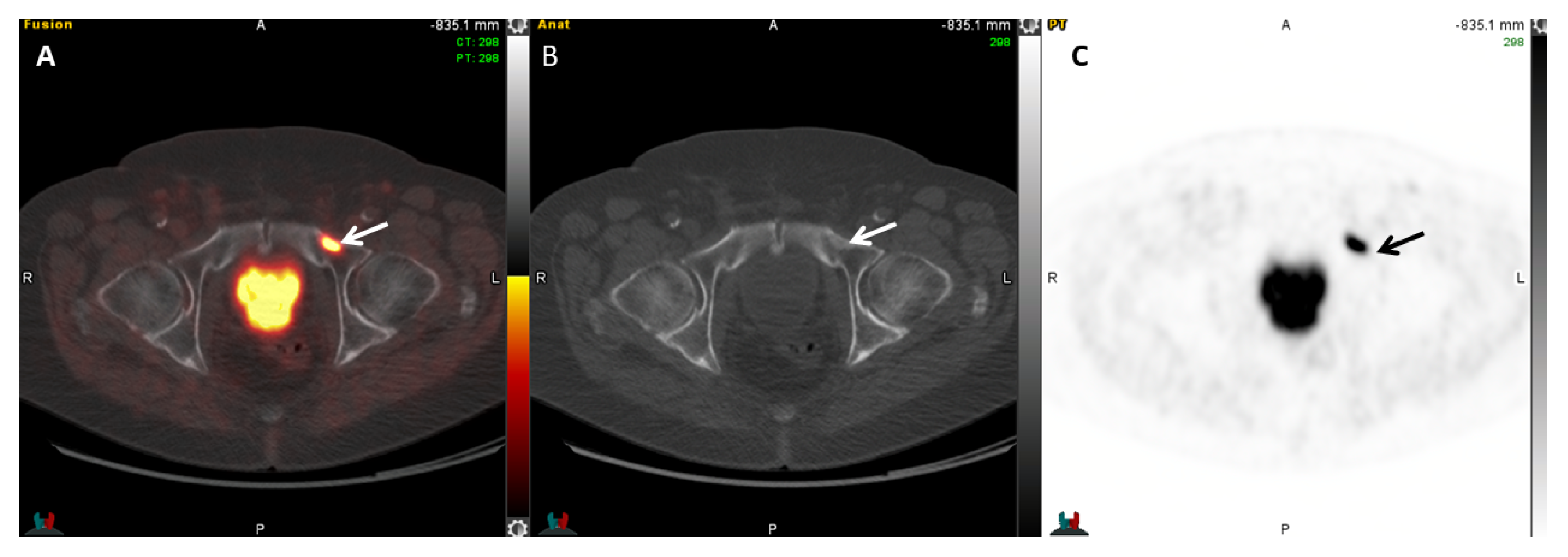 Cancers 17 01723 g006