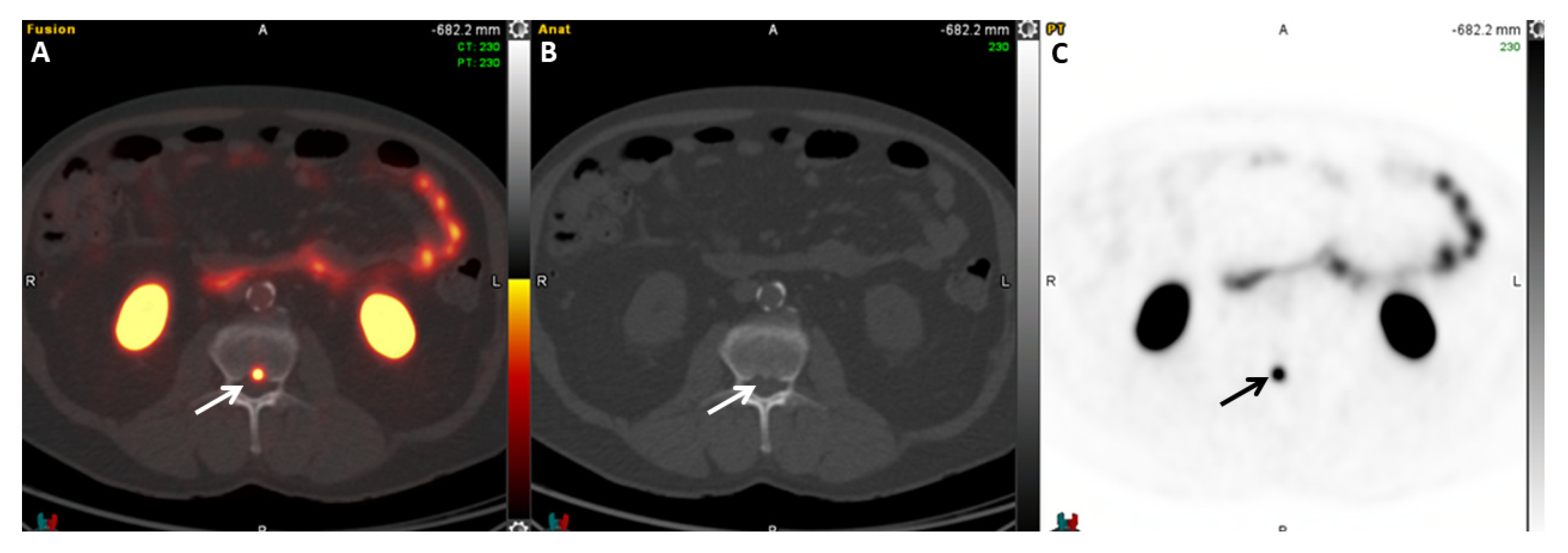 Cancers 17 01723 g007