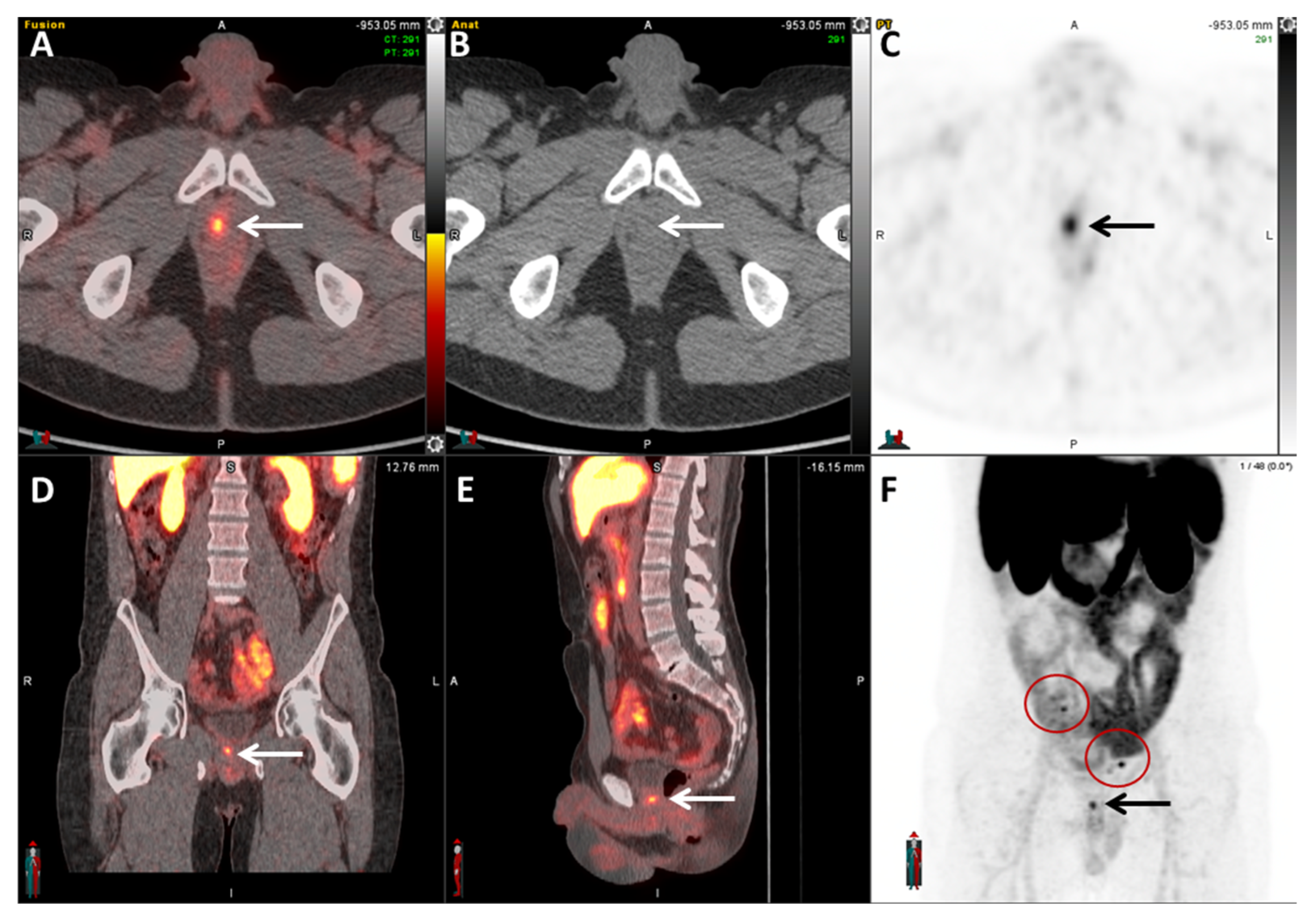 Cancers 17 01723 g008