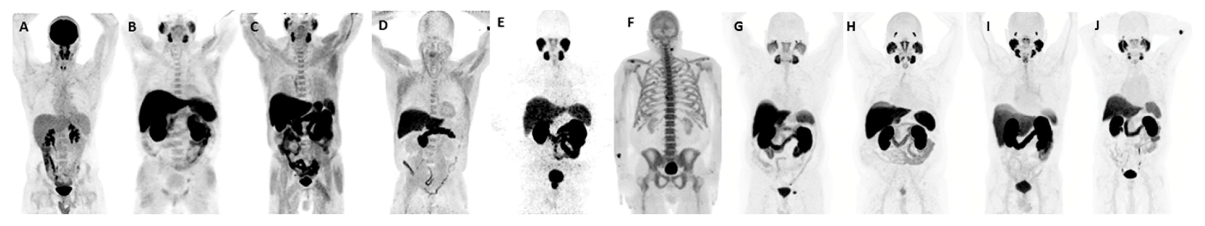 Cancers 17 01723 g009