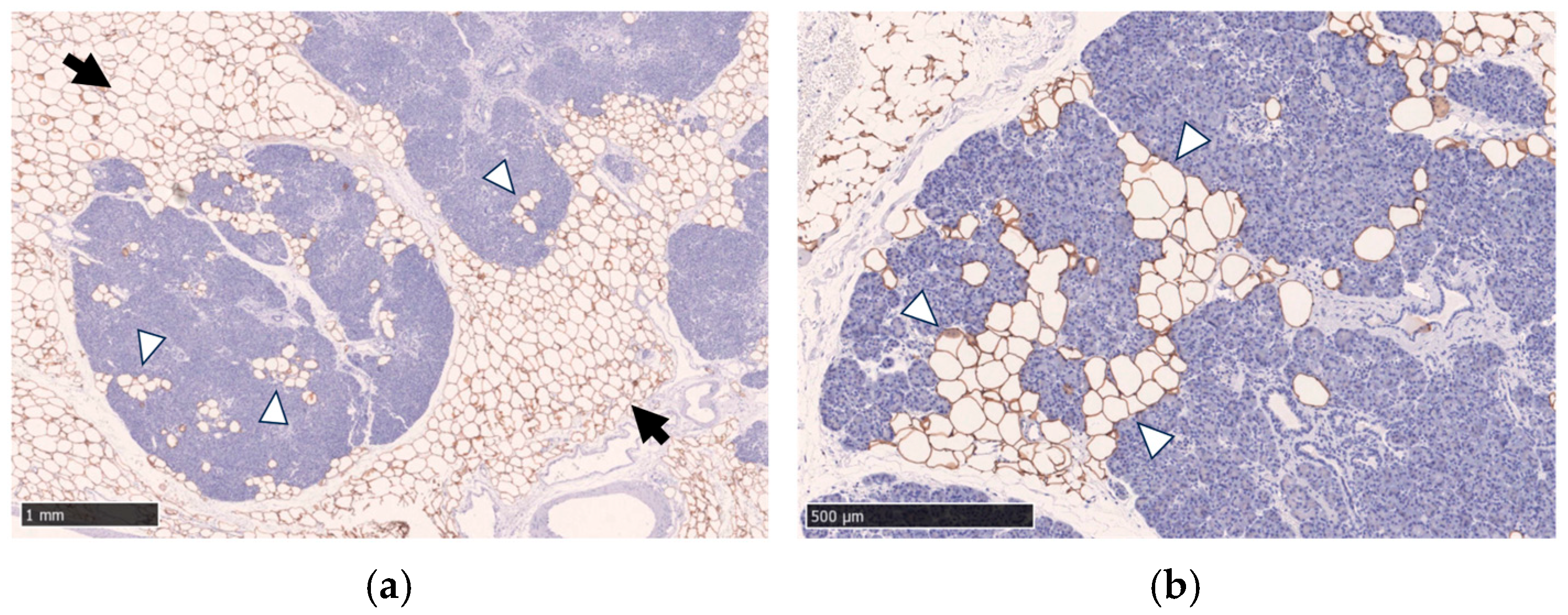 Cancers 17 01765 g001