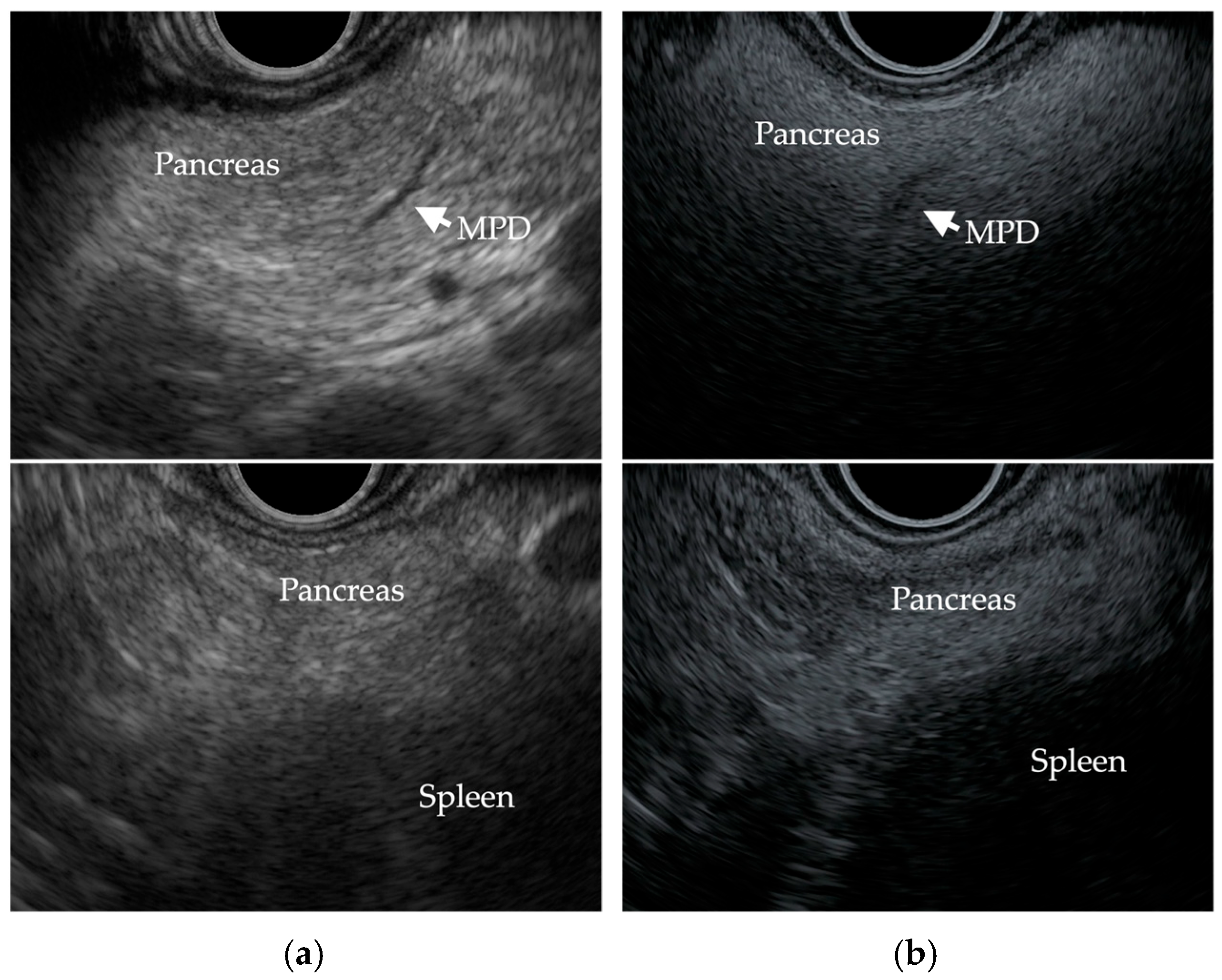 Cancers 17 01765 g003