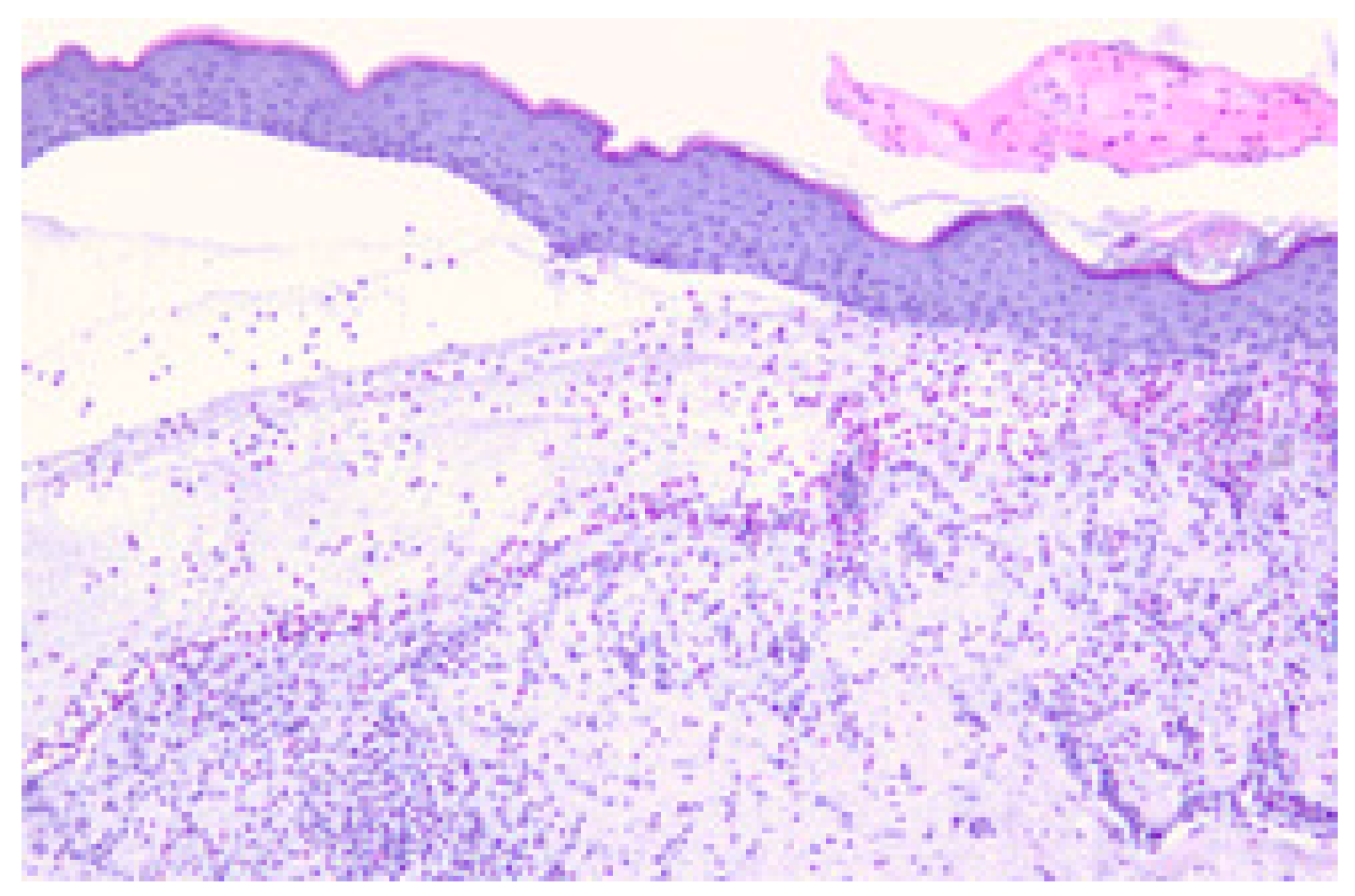 Cancers 17 01845 g006