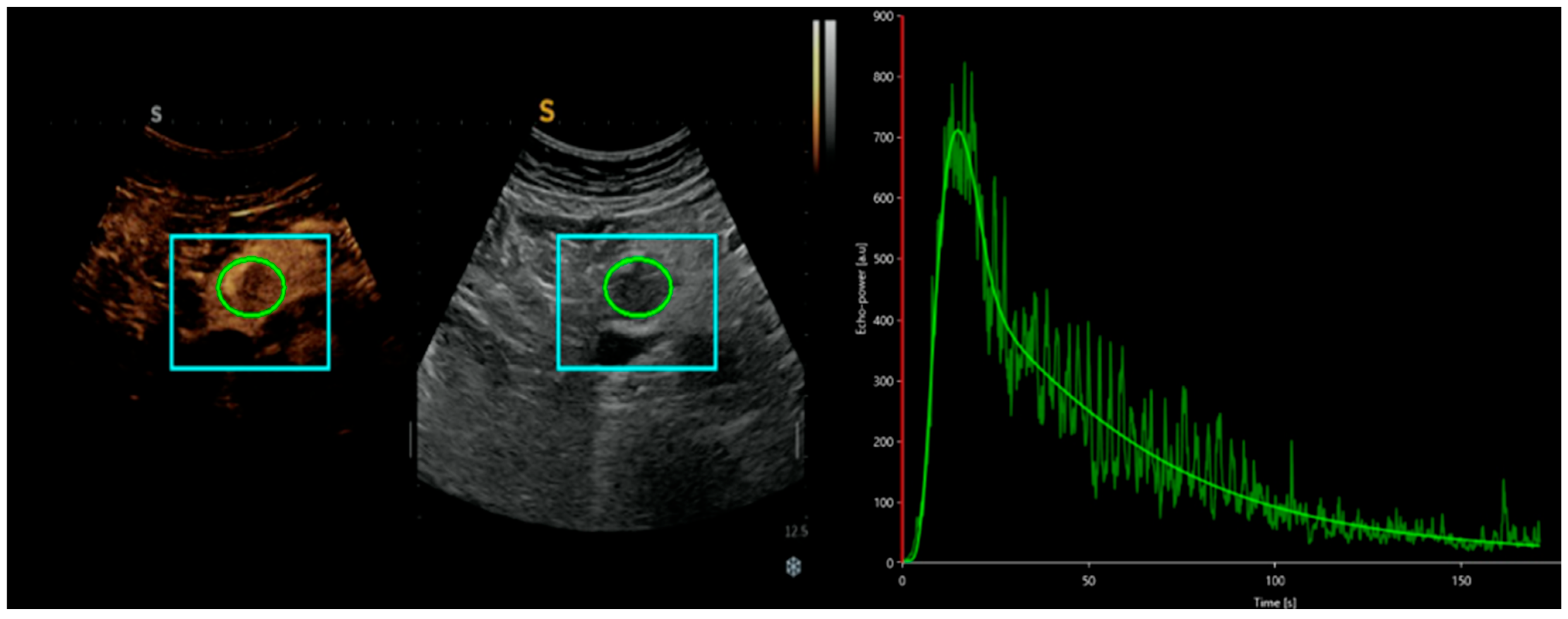 Cancers 17 01879 g001