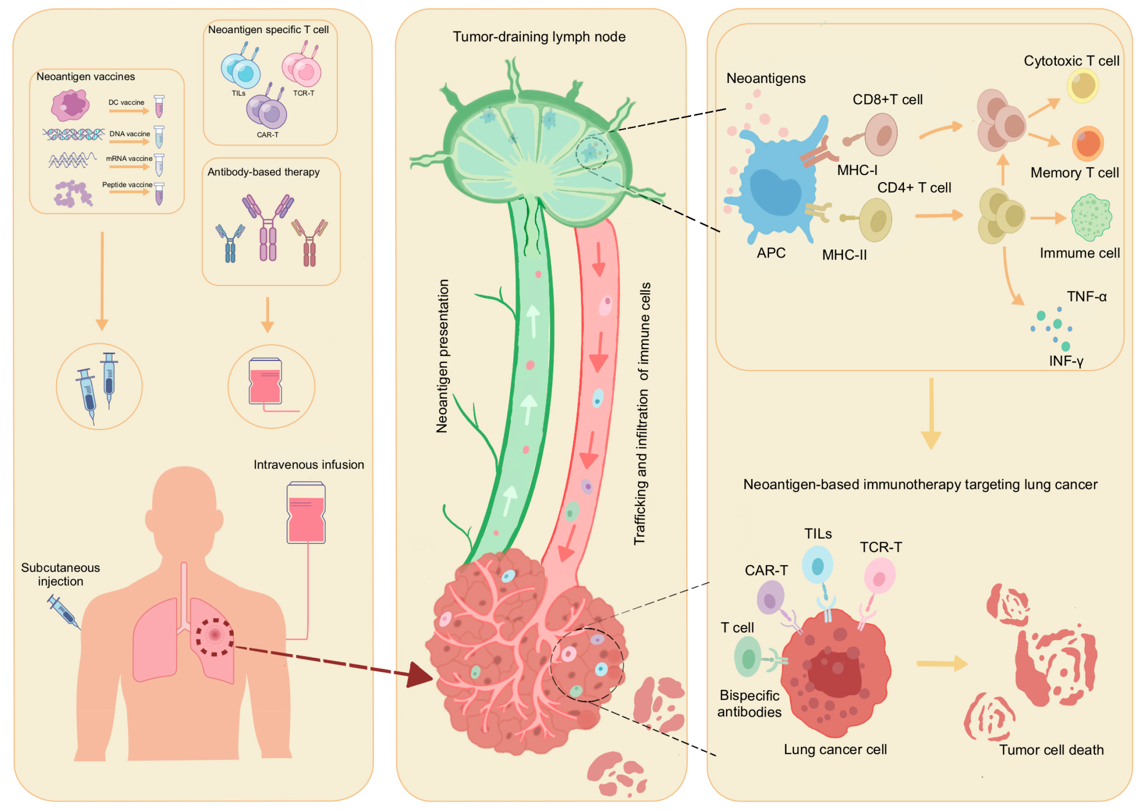 Cancers 17 01953 g002
