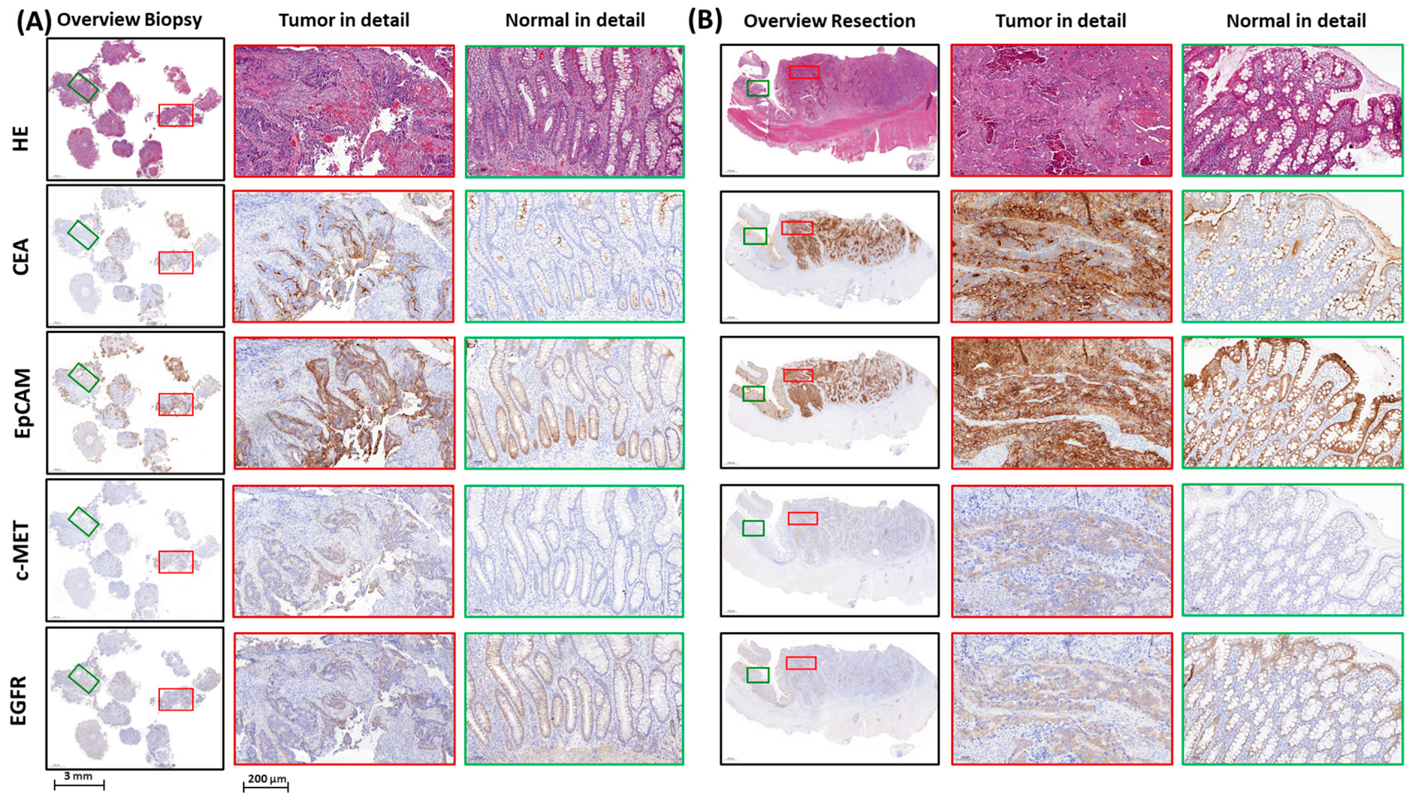 Cancers 17 01958 g002