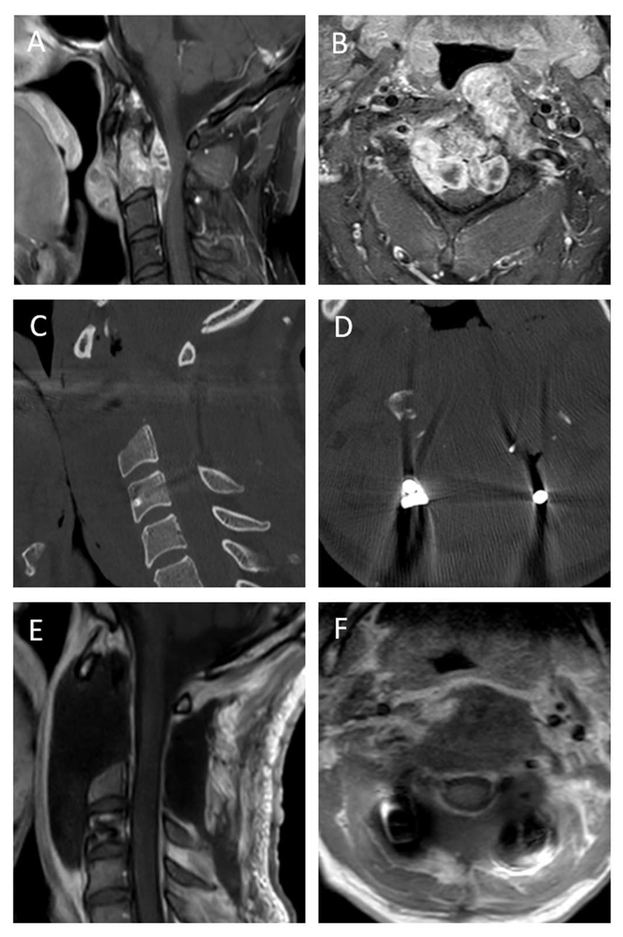 Cancers 17 01989 g004