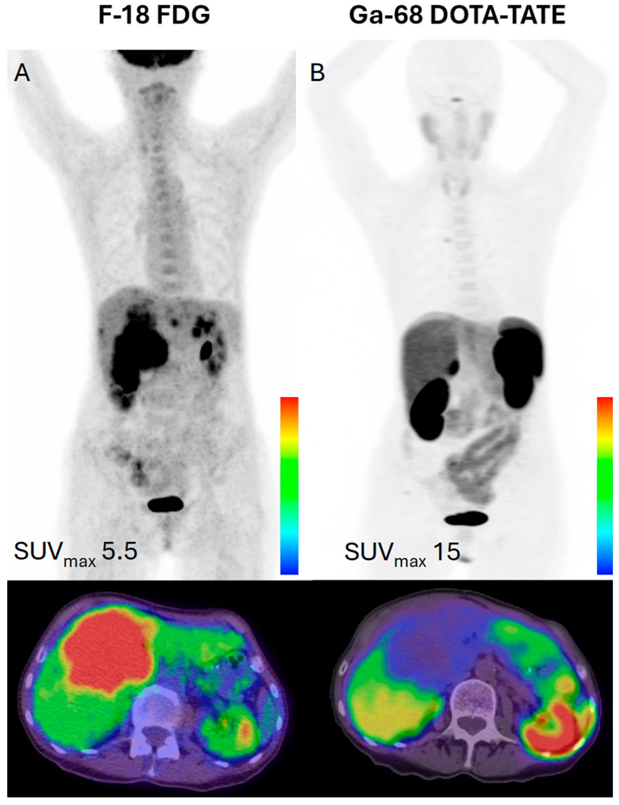 Cancers 17 02013 g001