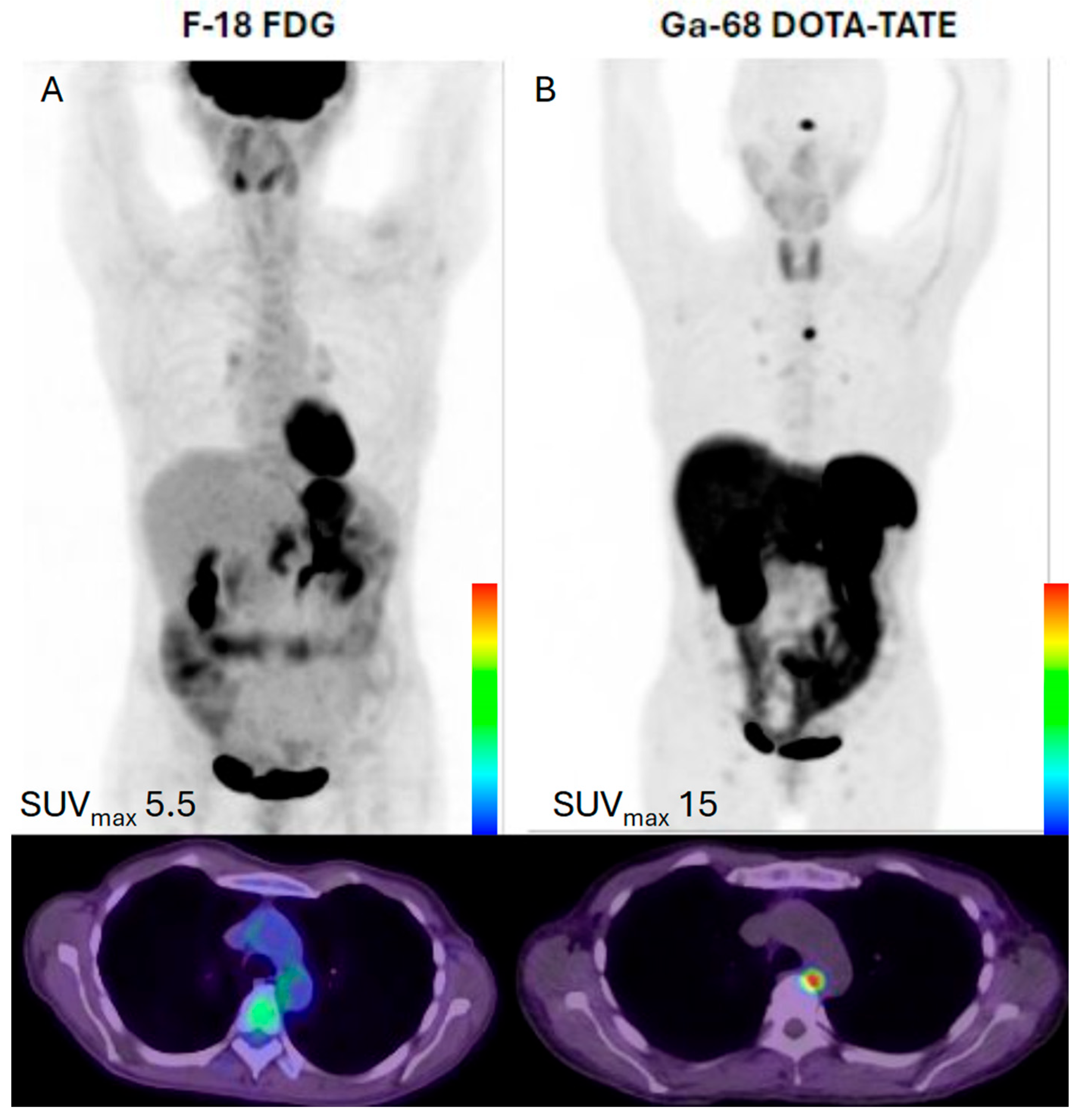 Cancers 17 02013 g002