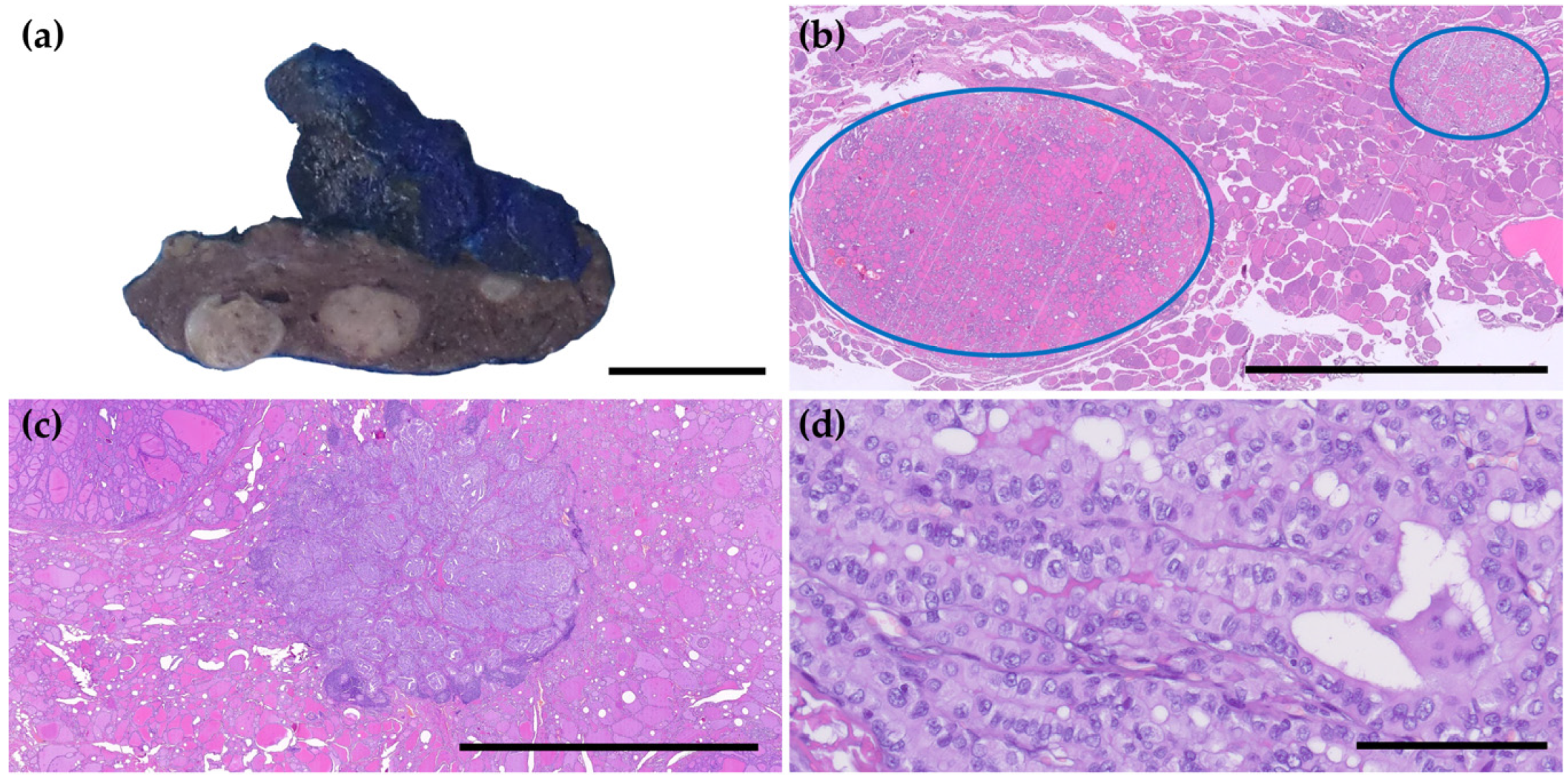 Cancers 17 02021 g002