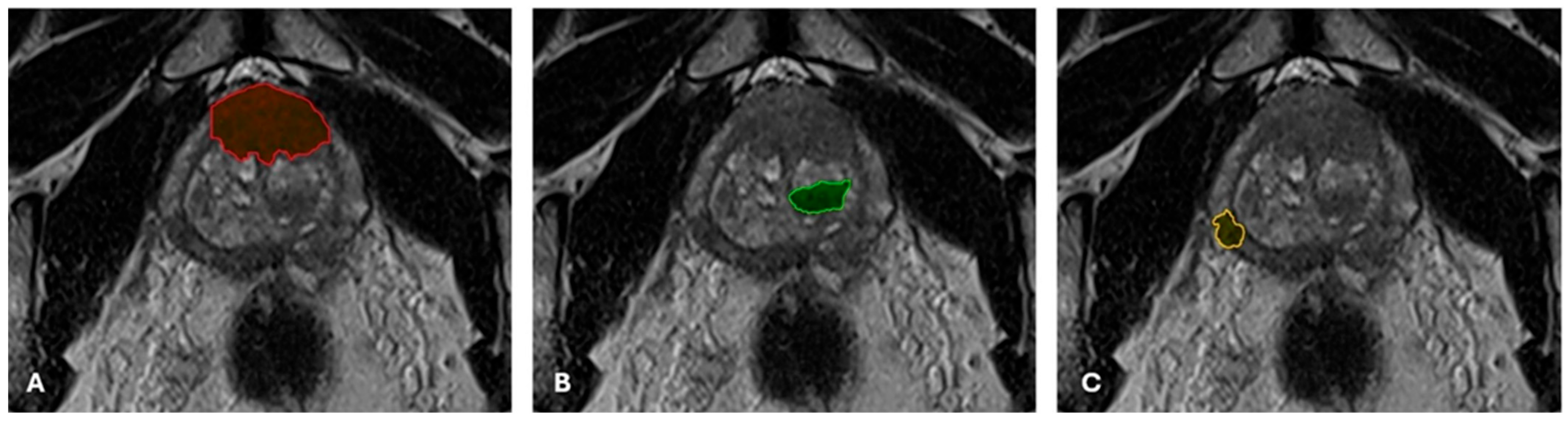 Cancers 17 02035 g001