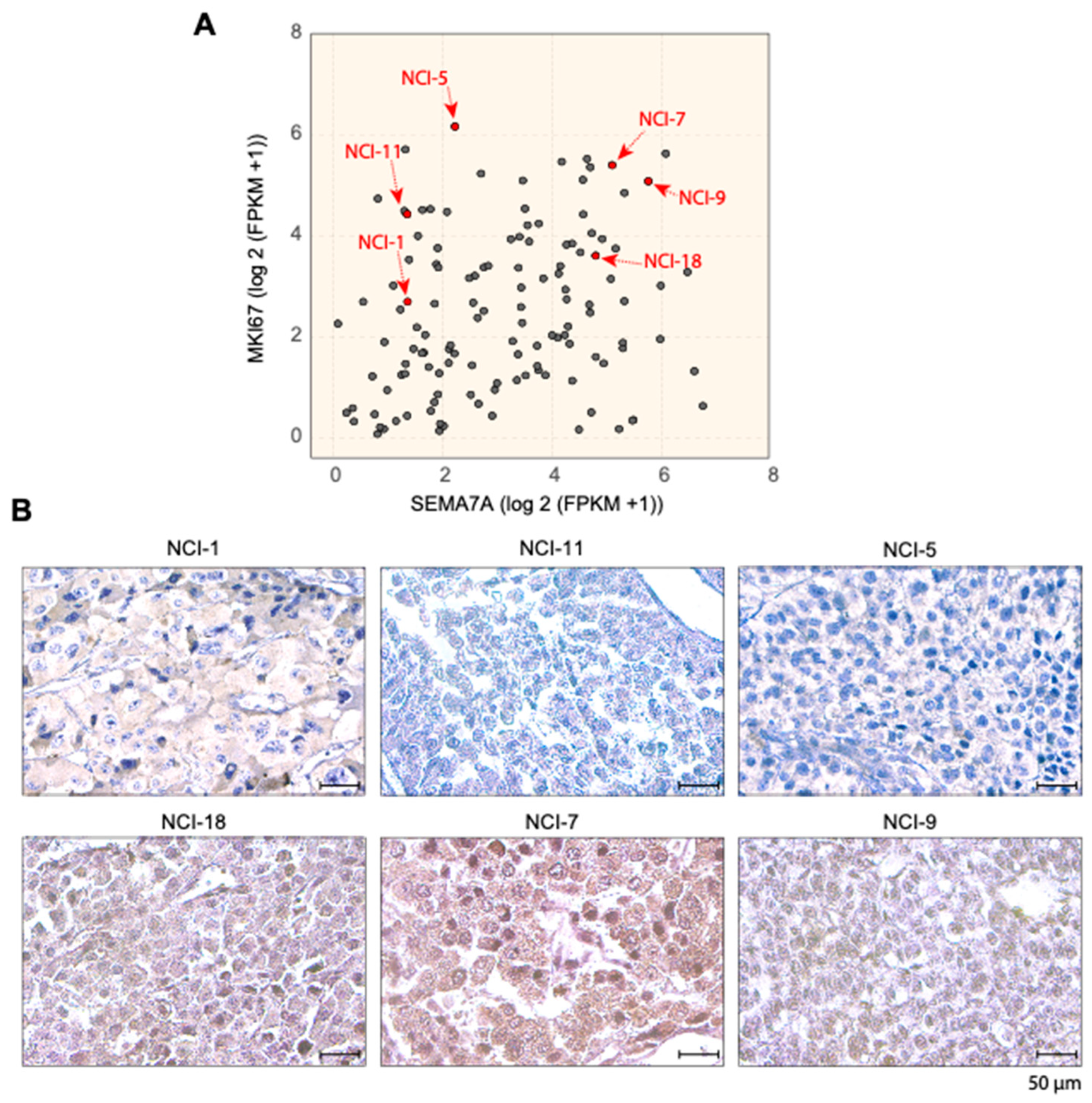 Cancers 17 02078 g005