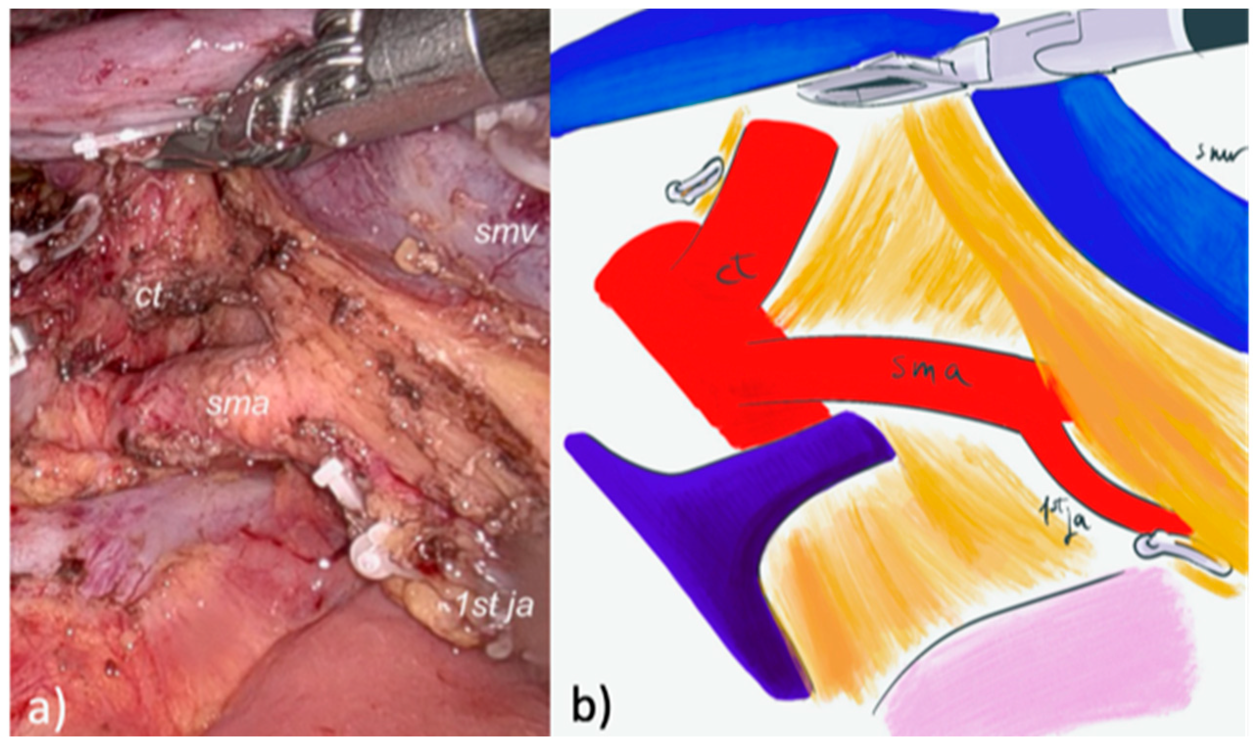 Cancers 17 02103 g002