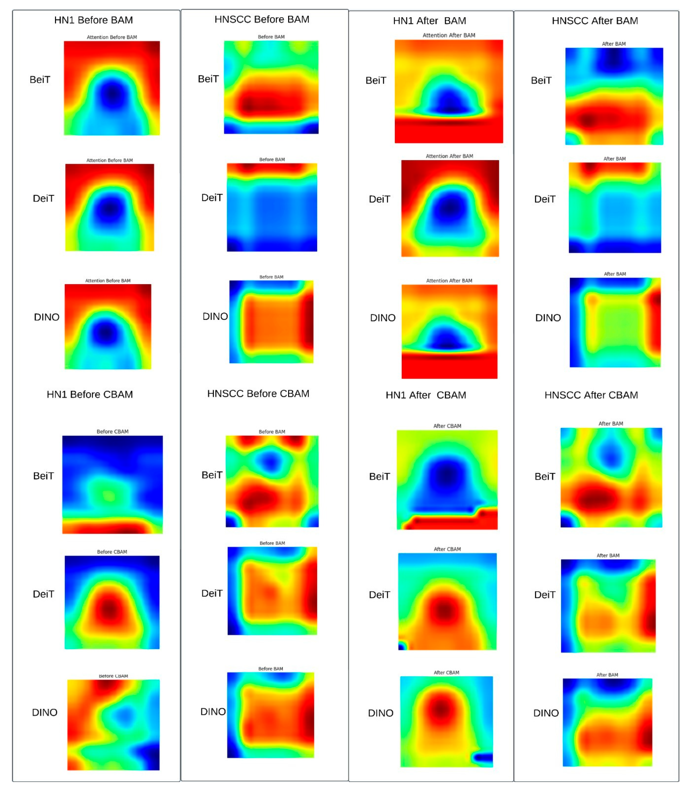 Cancers 17 02115 g007