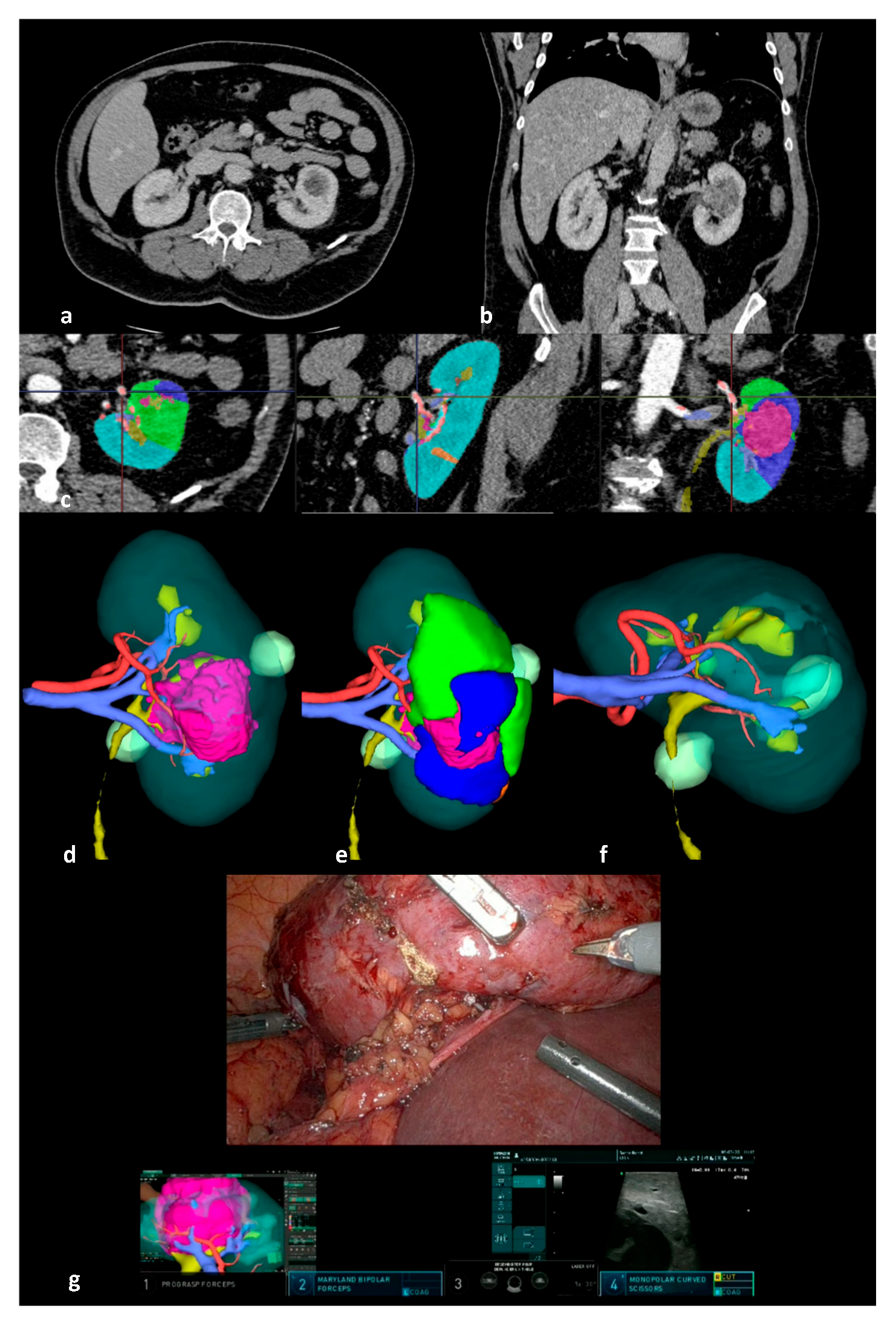 Cancers 17 02127 g001