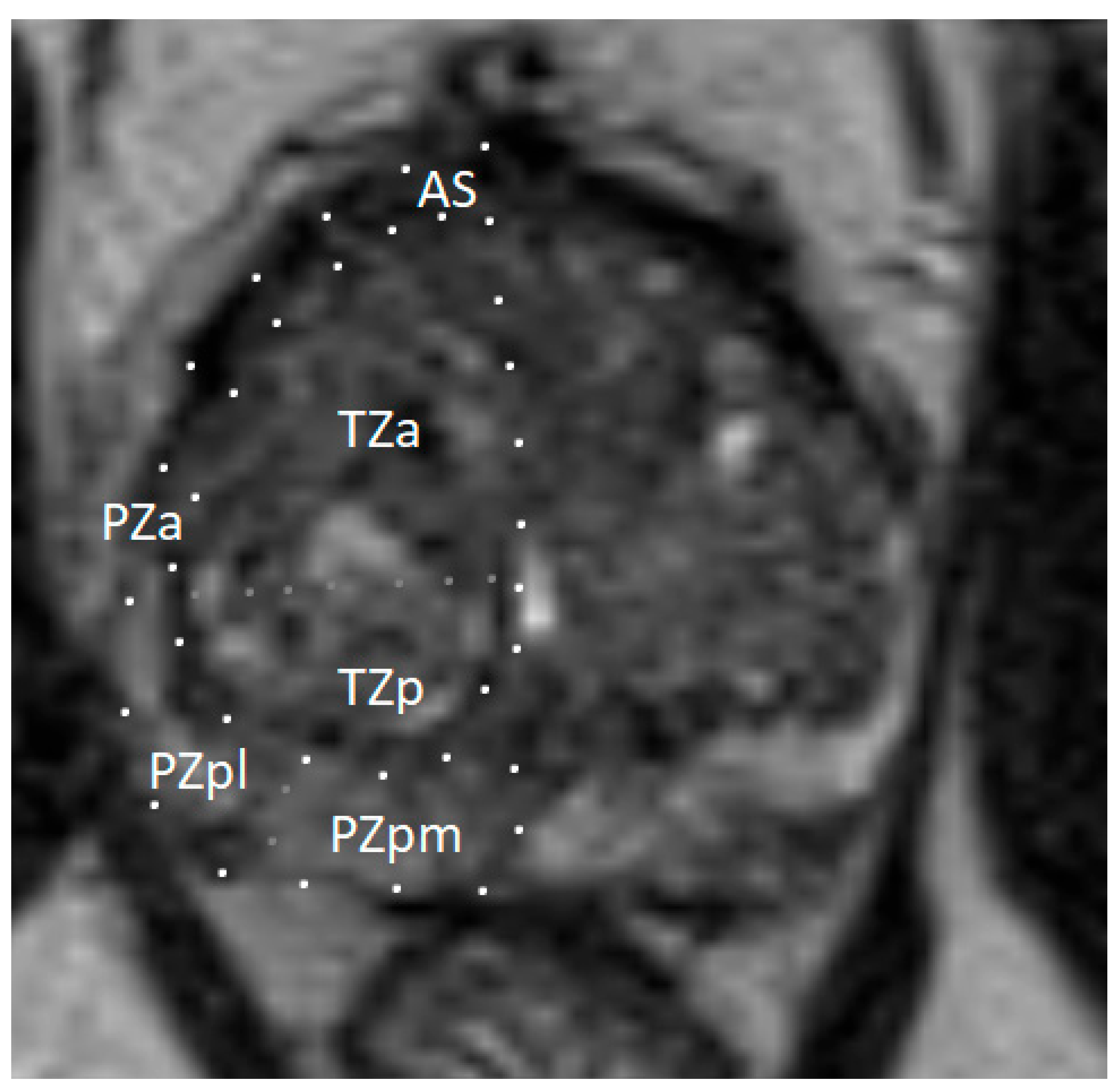 Cancers 17 02137 g001
