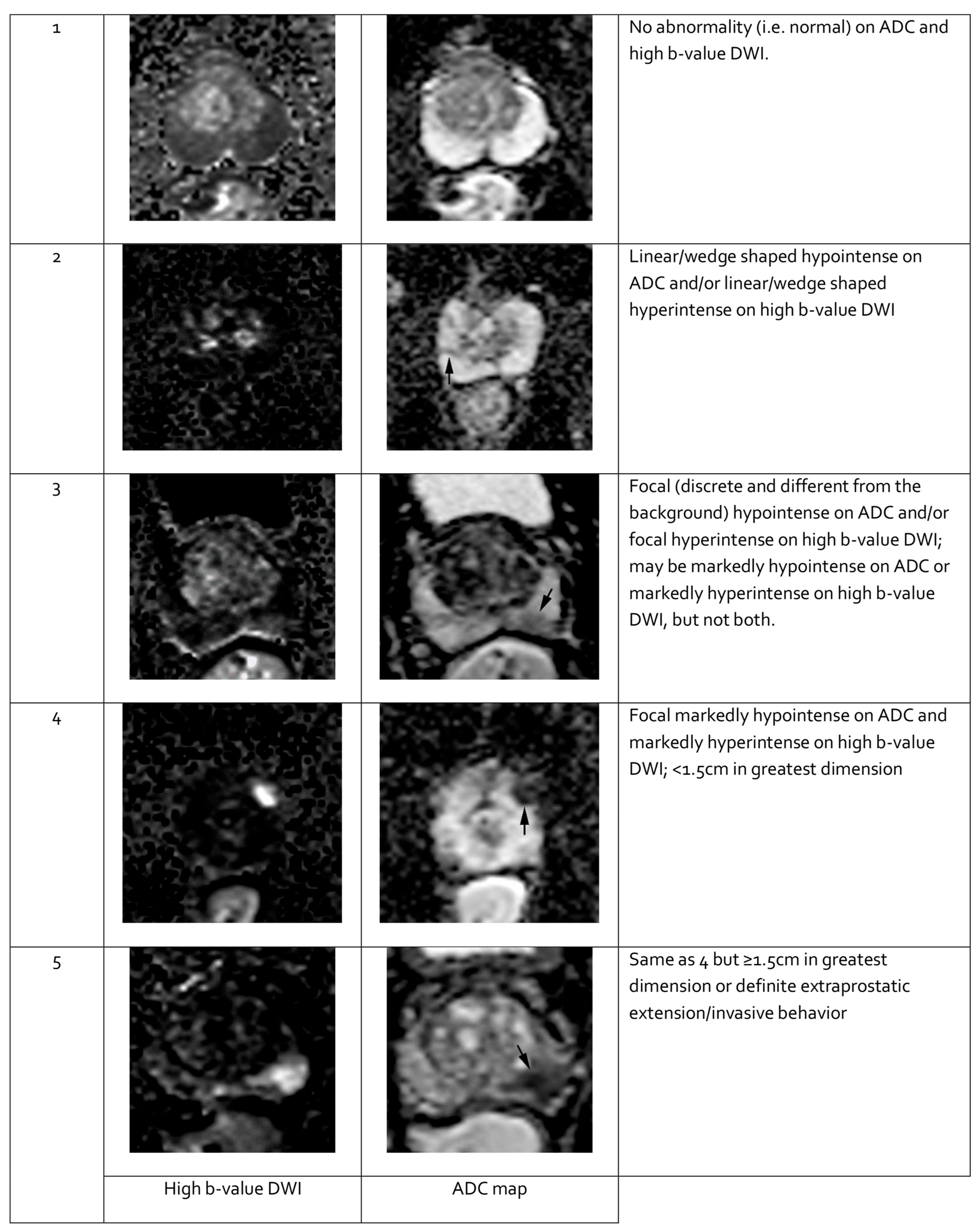 Cancers 17 02137 g003