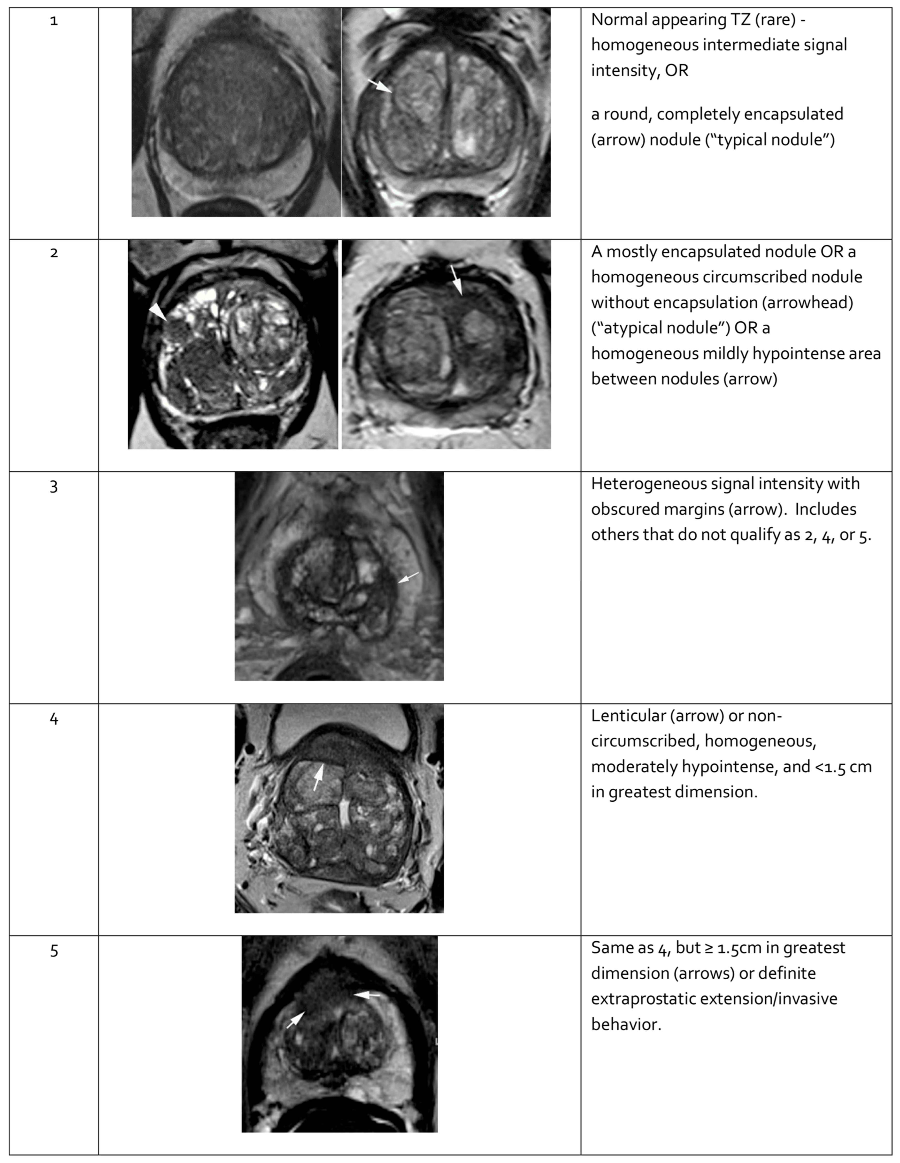 Cancers 17 02137 g004