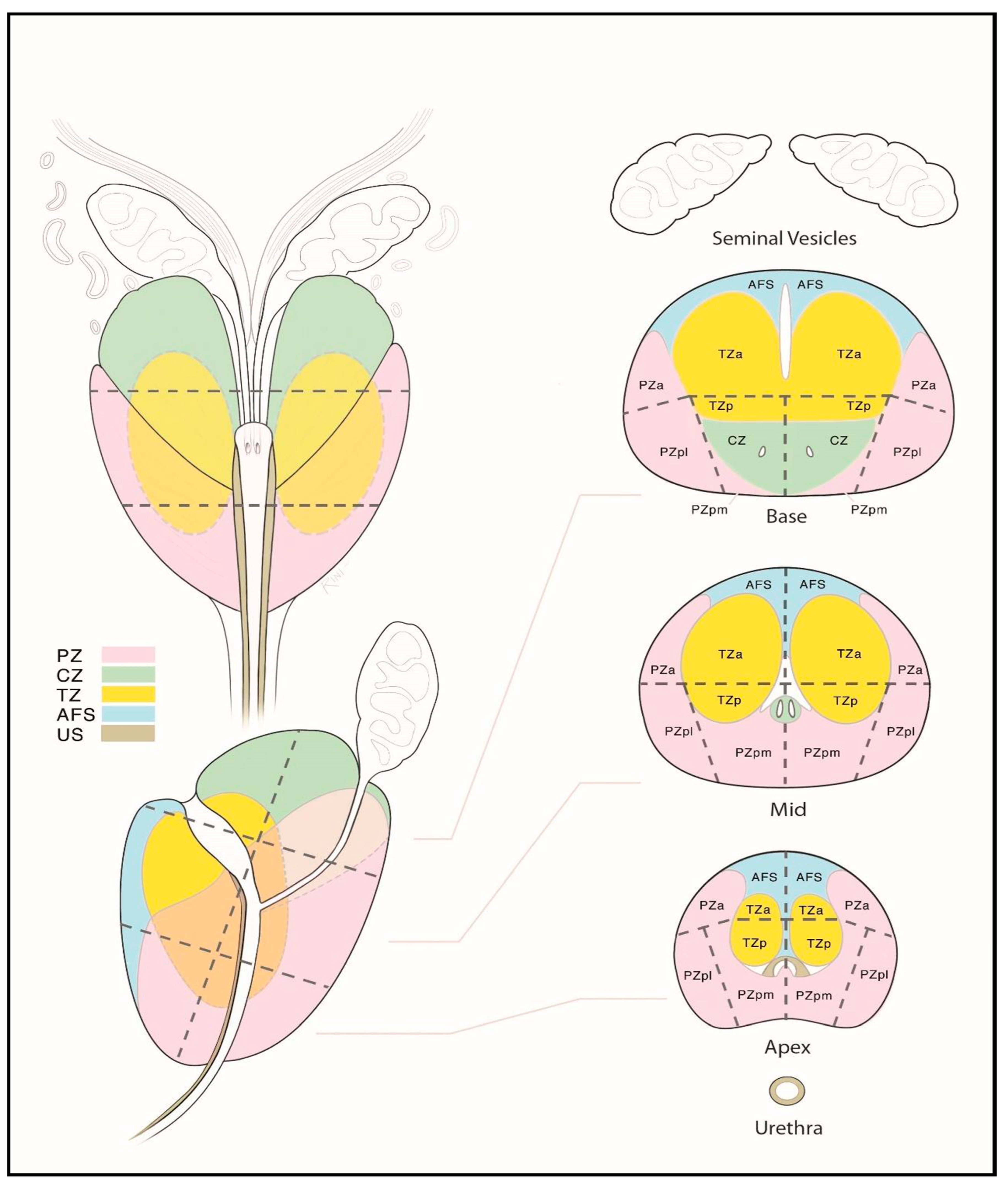 Cancers 17 02137 g005