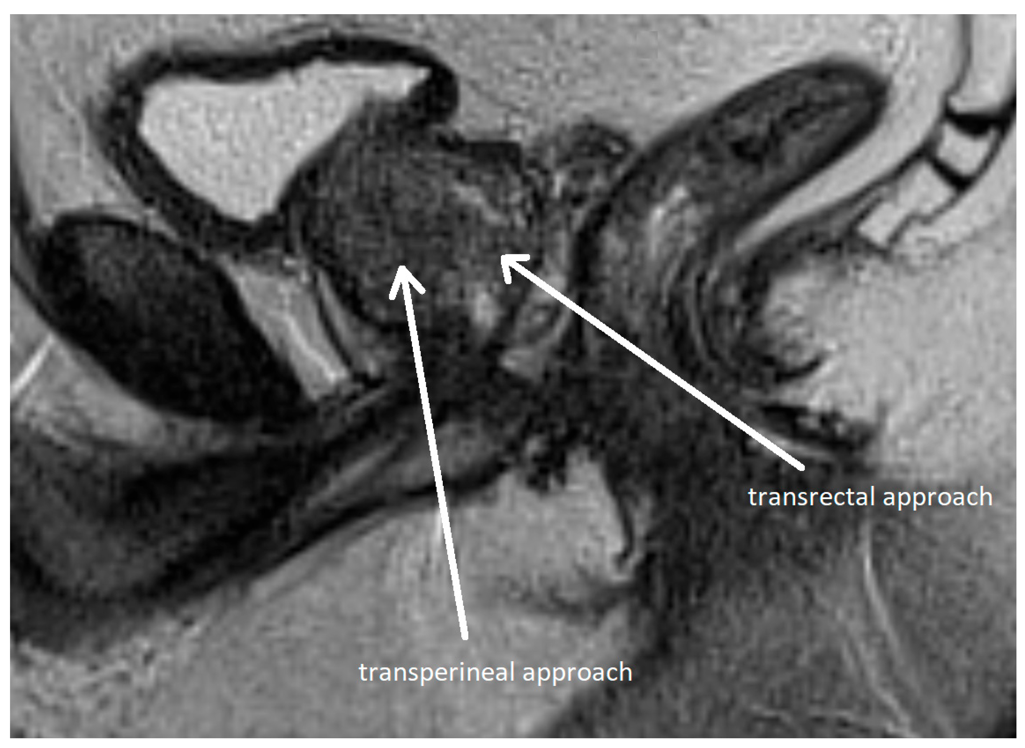 Cancers 17 02137 g006