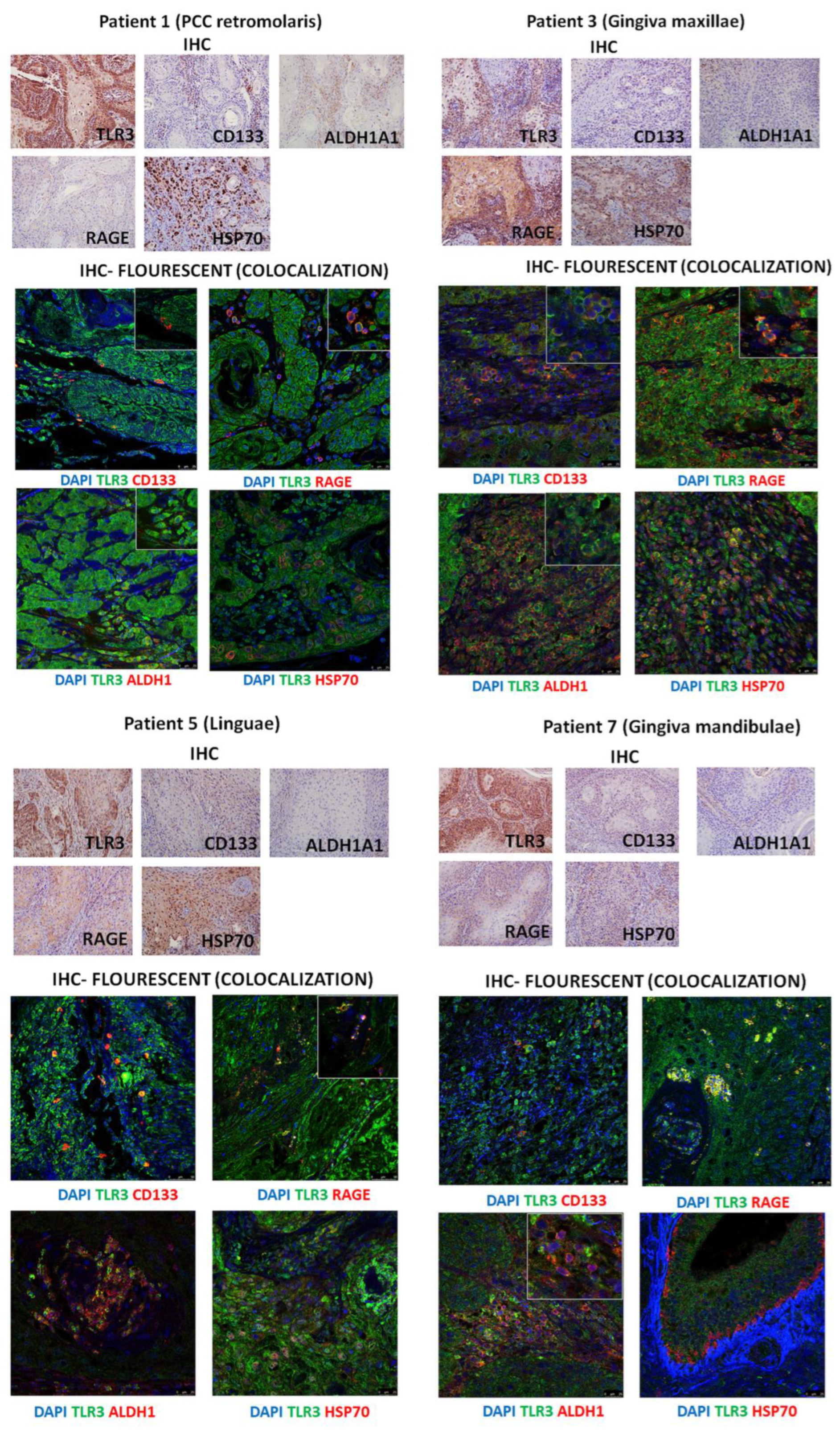 Cancers 17 02157 g004