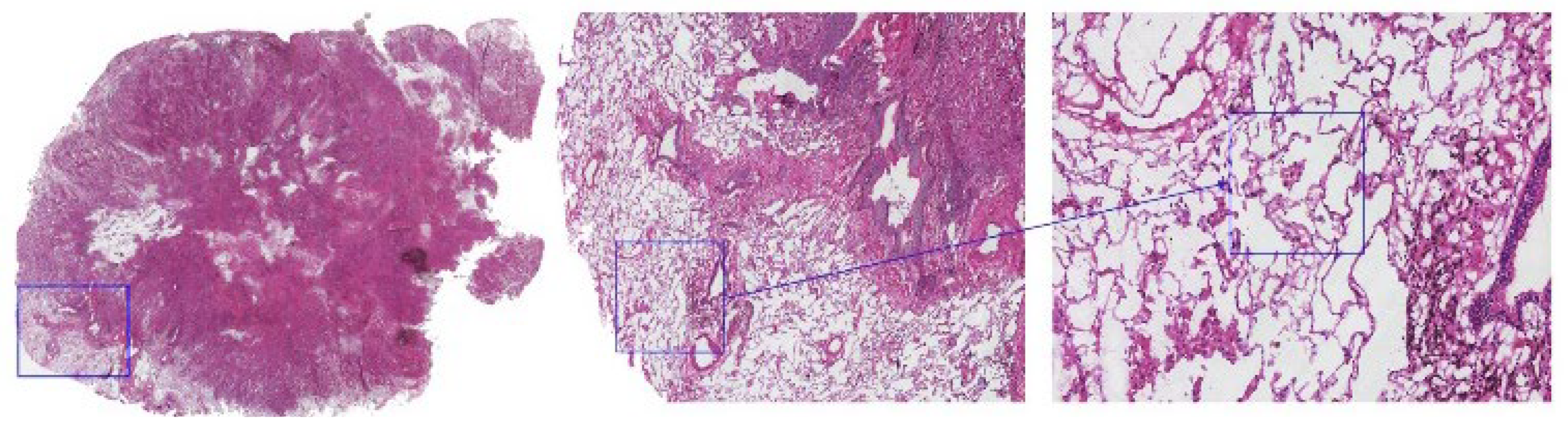 Cancers 17 02168 g001