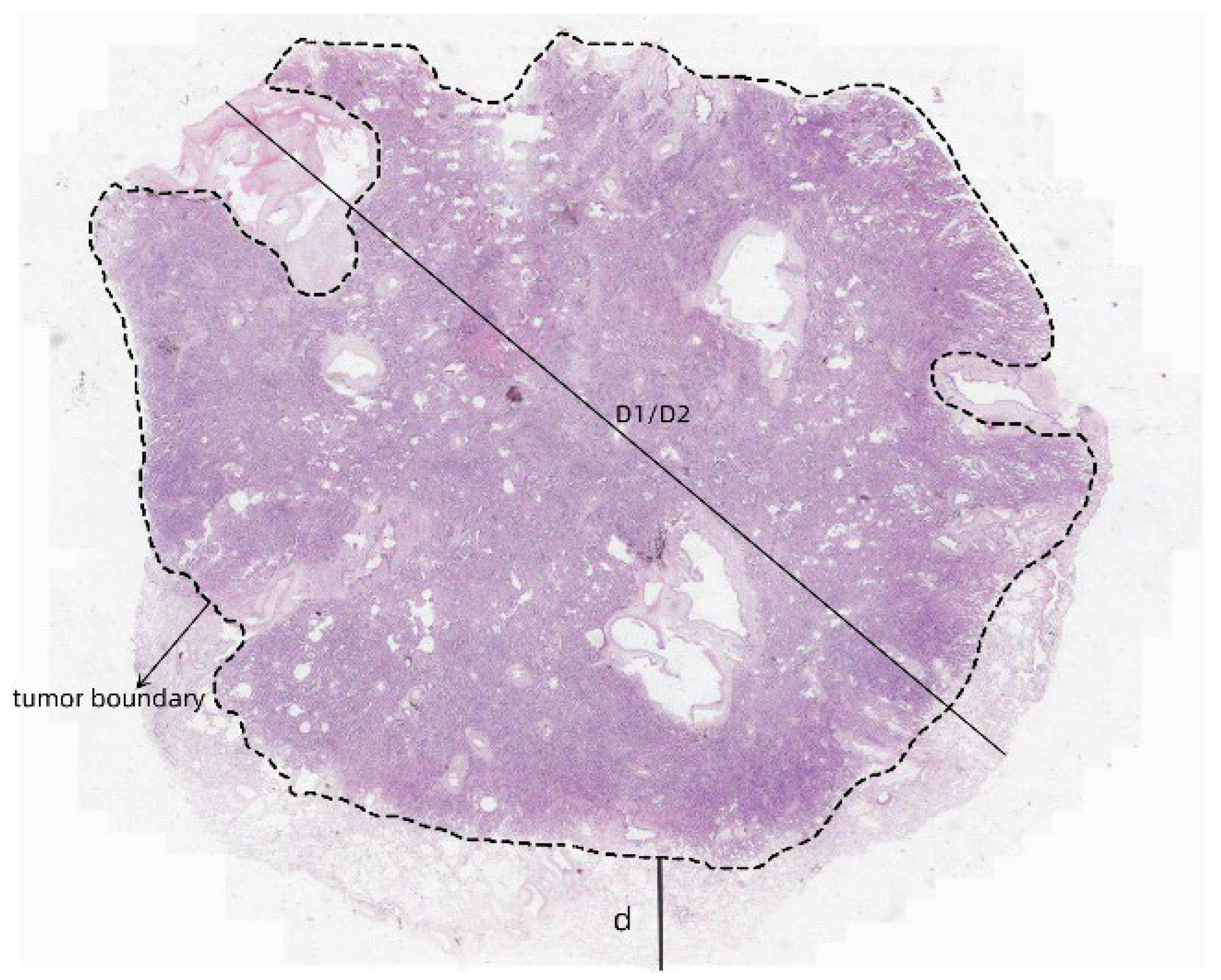 Cancers 17 02168 g002