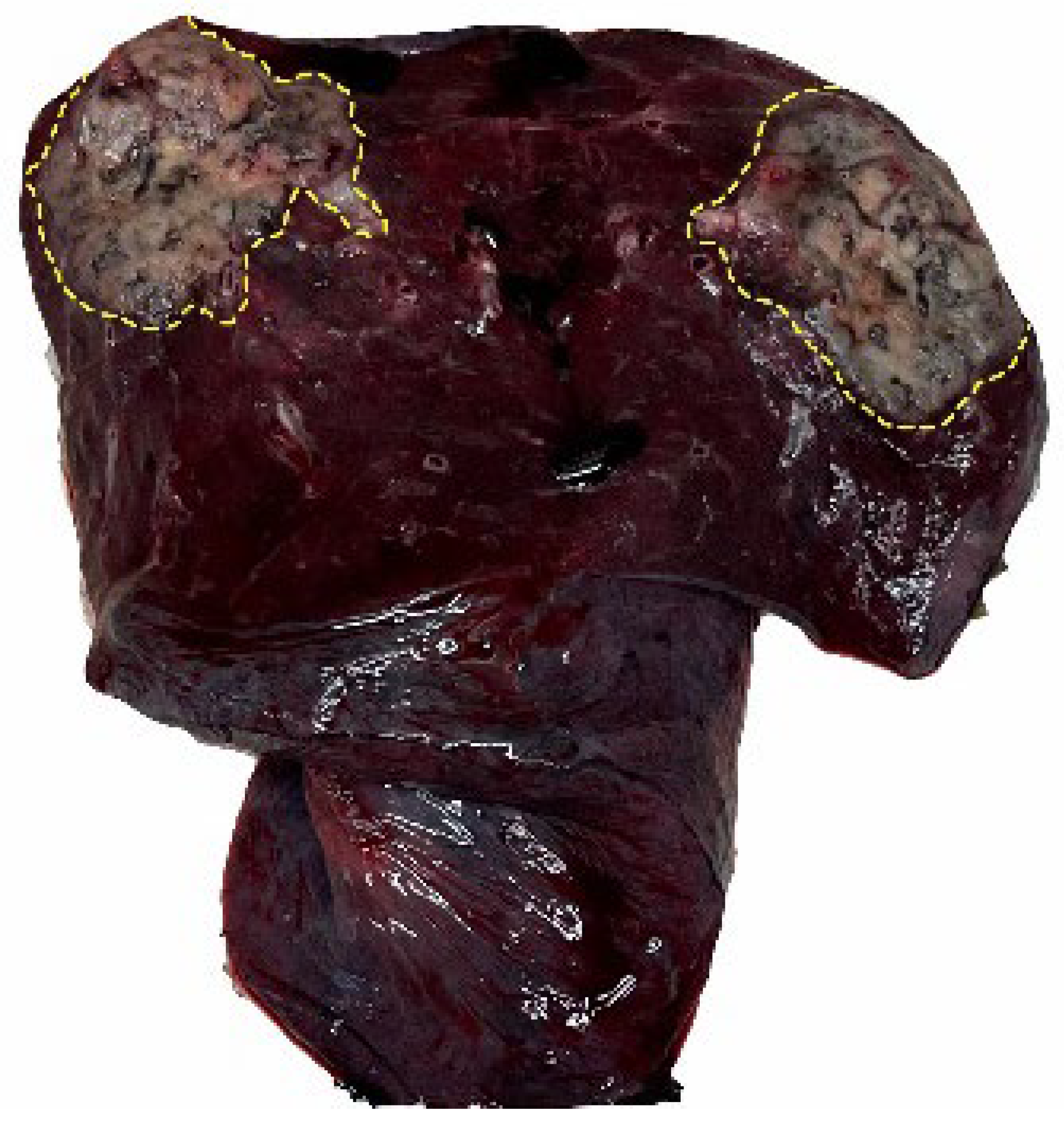 Cancers 17 02168 g003