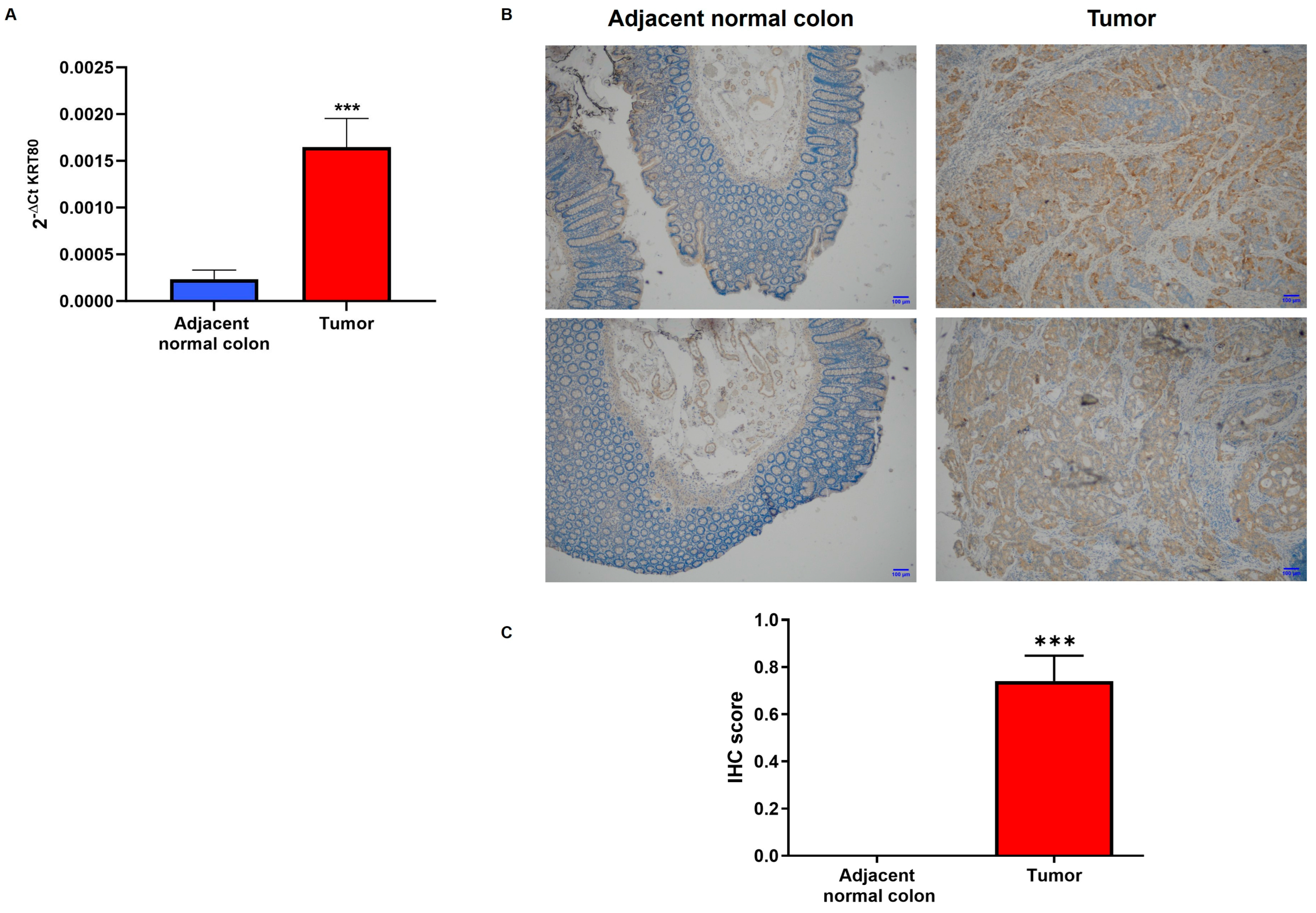 Cancers 17 02183 g002