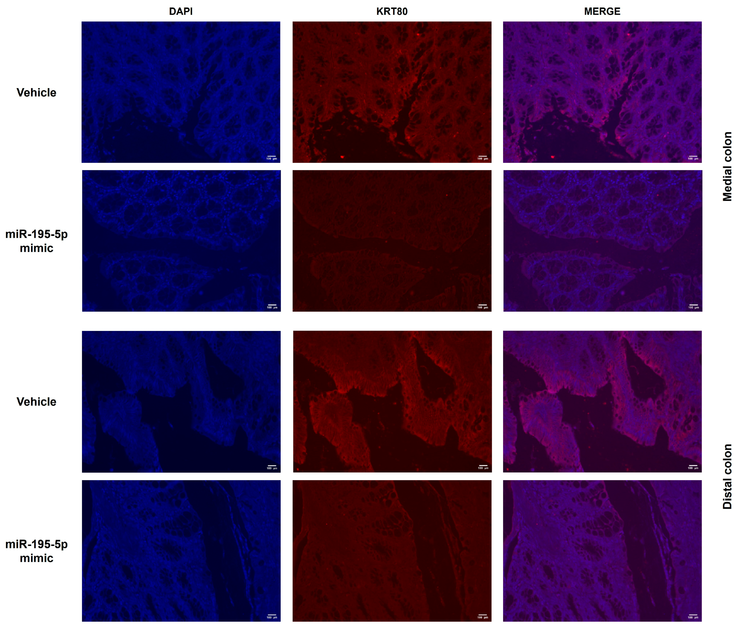 Cancers 17 02183 g006