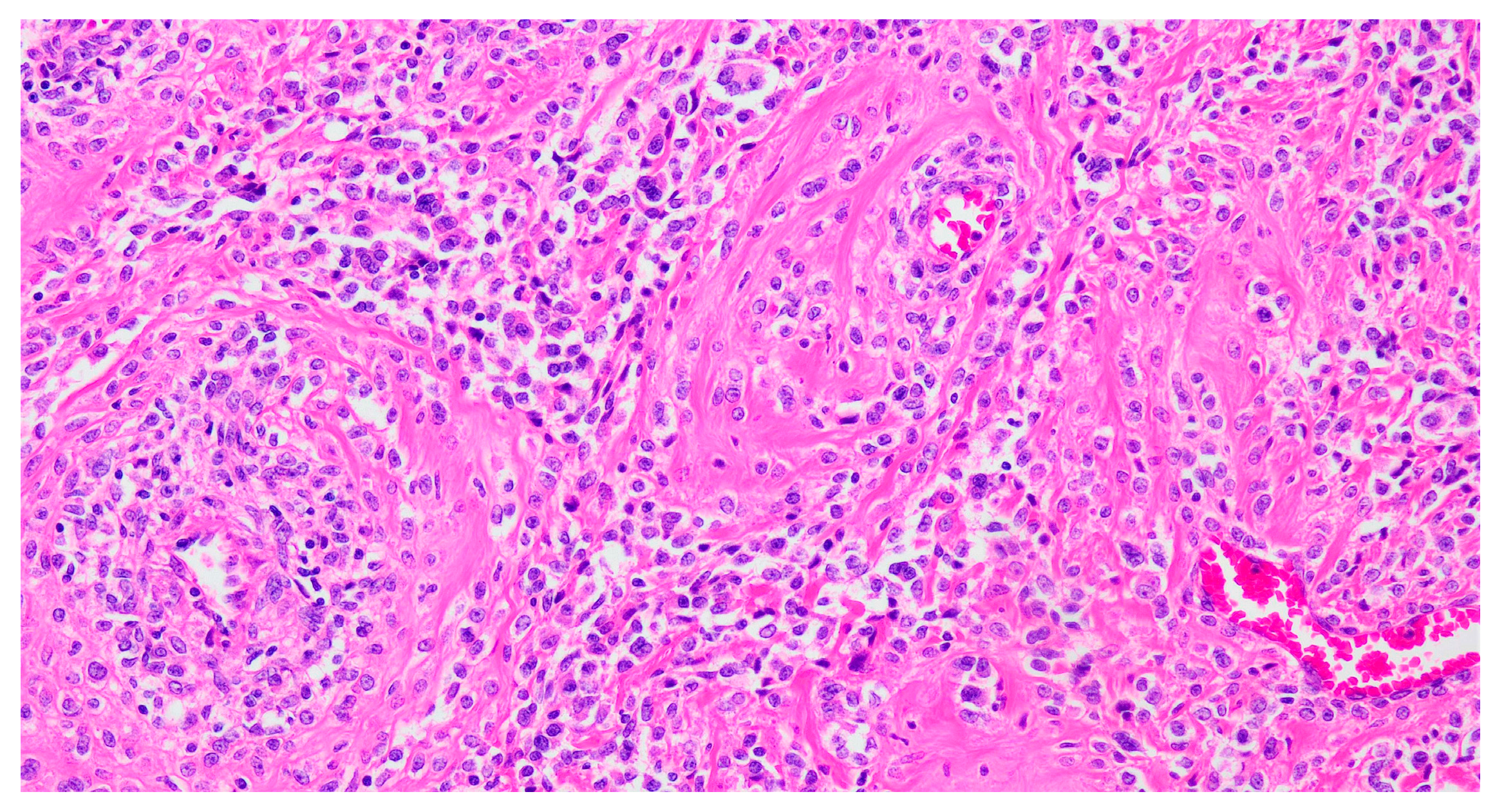 Cancers 17 02185 g002