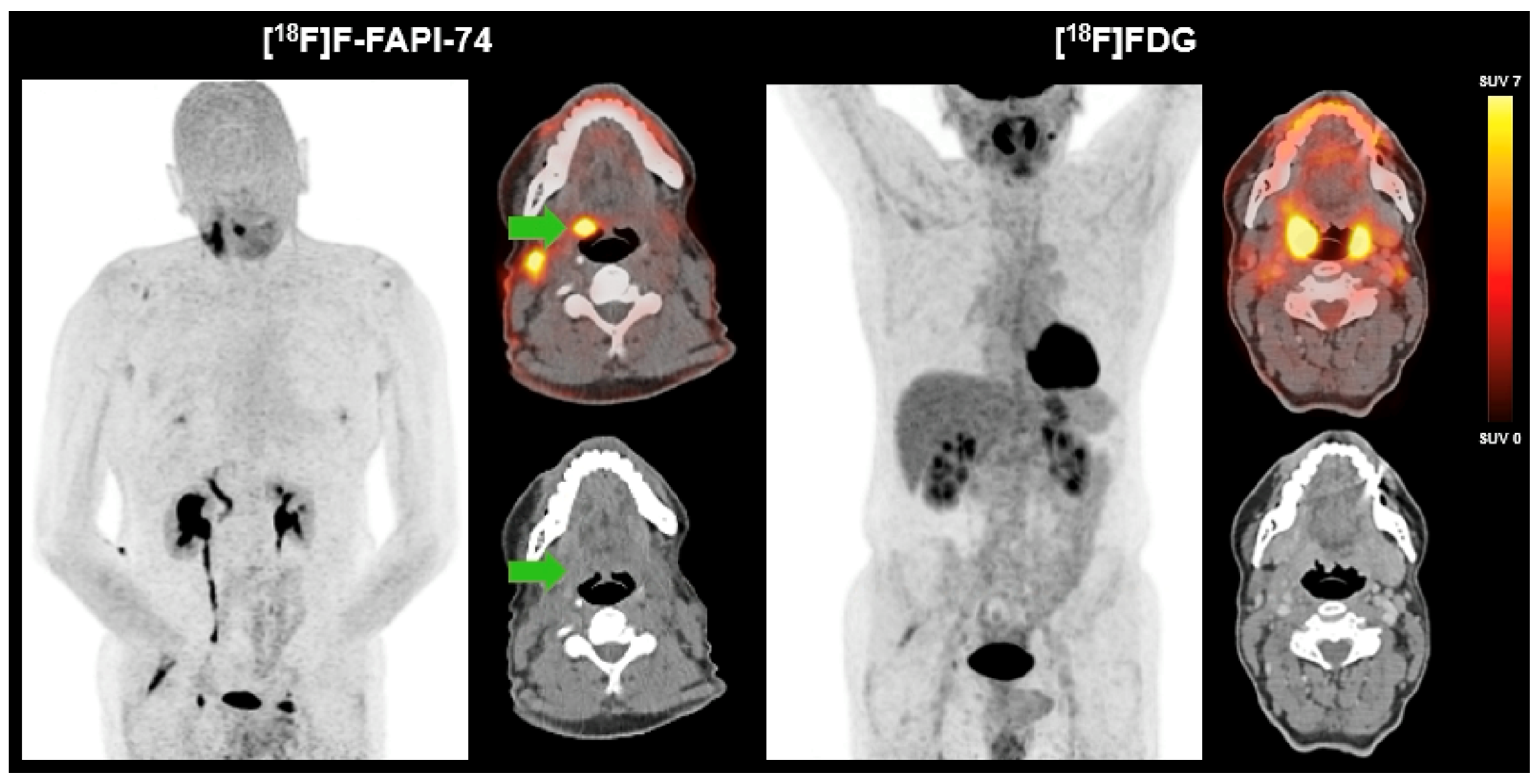 Cancers 17 02205 g001