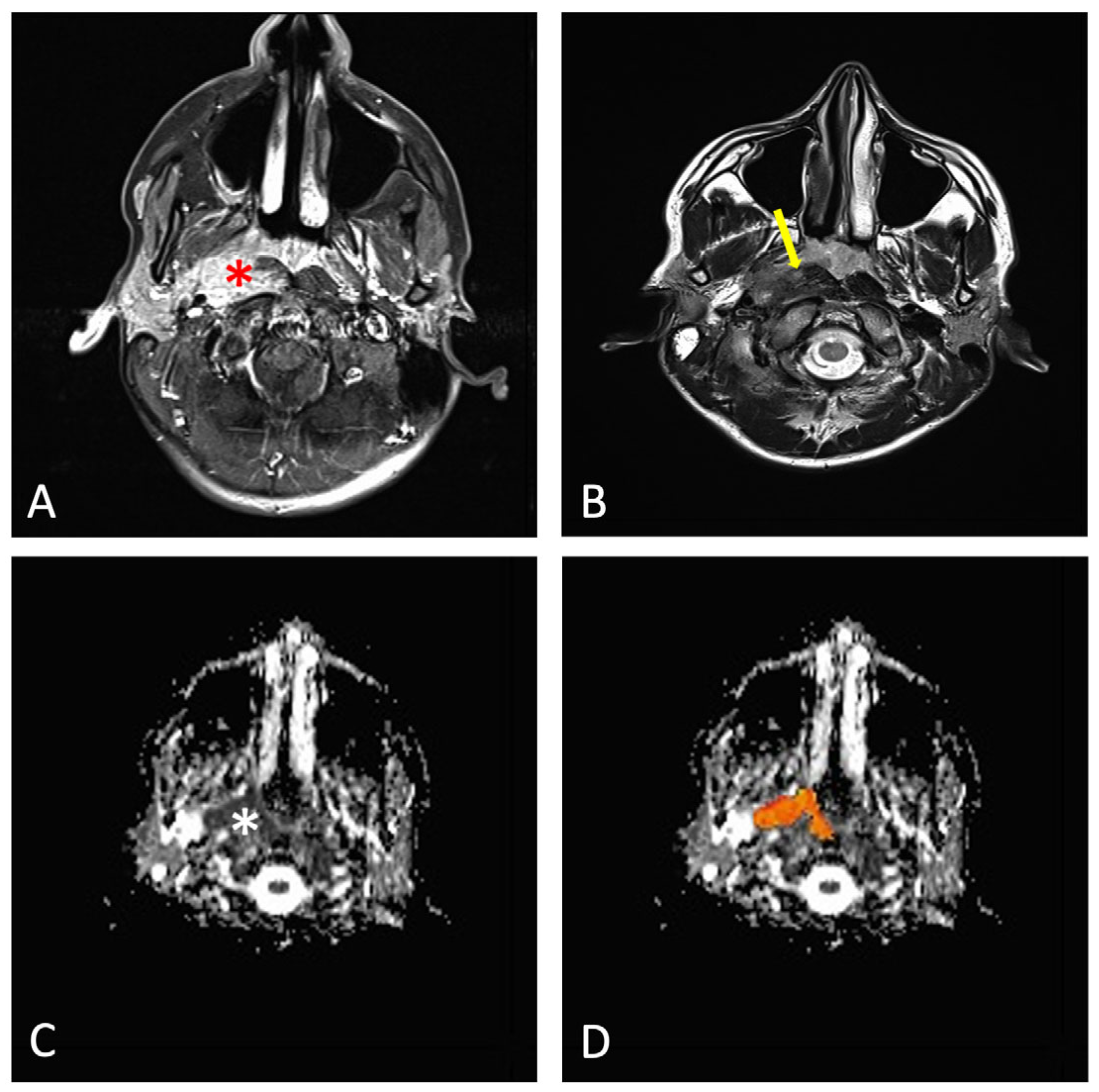 Cancers 17 02237 g001