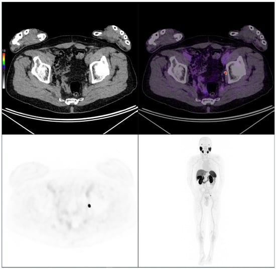 Cancers 17 02249 g007