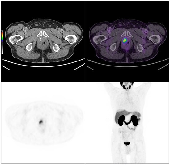 Cancers 17 02249 g008