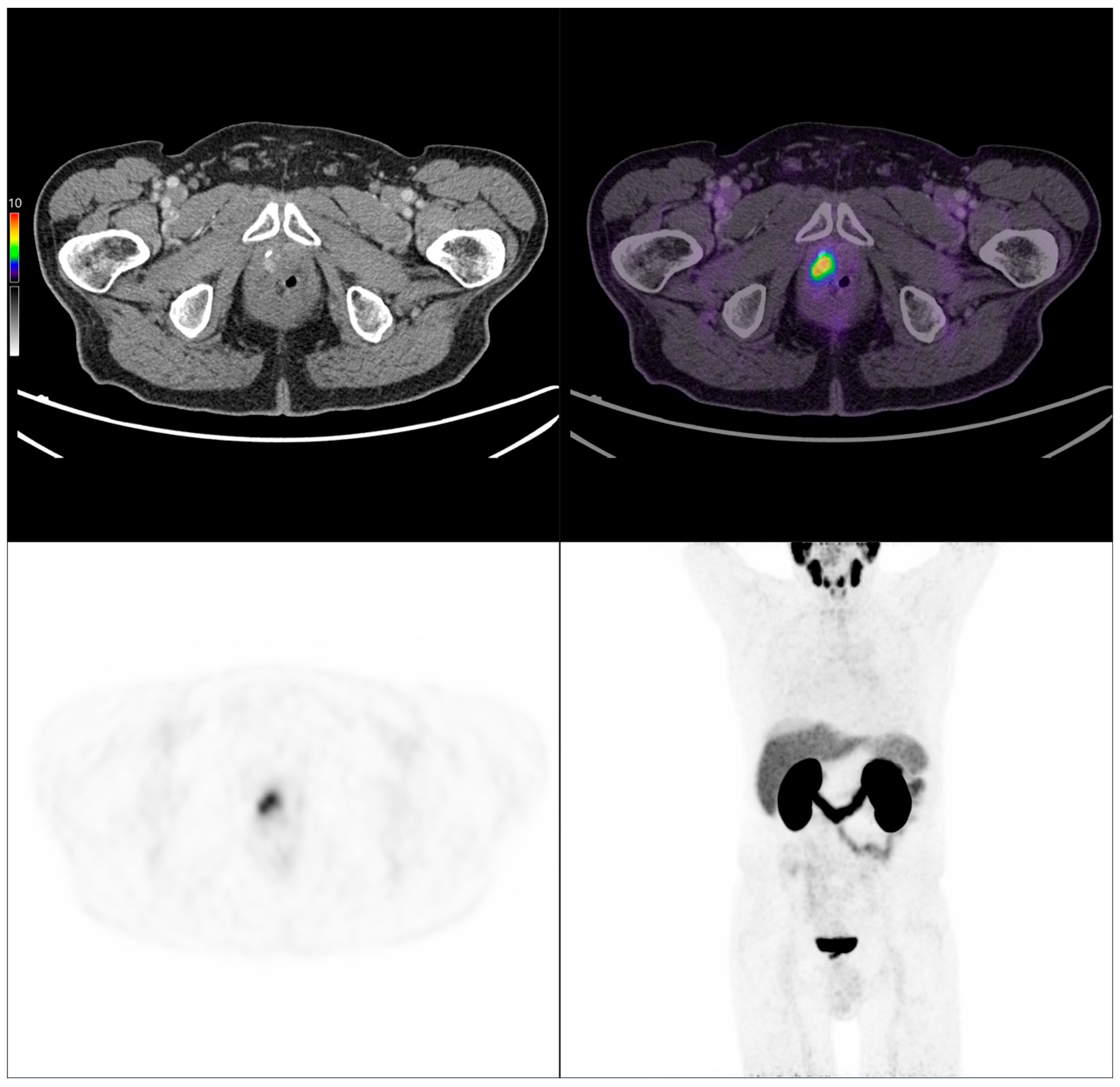 Cancers 17 02249 g008