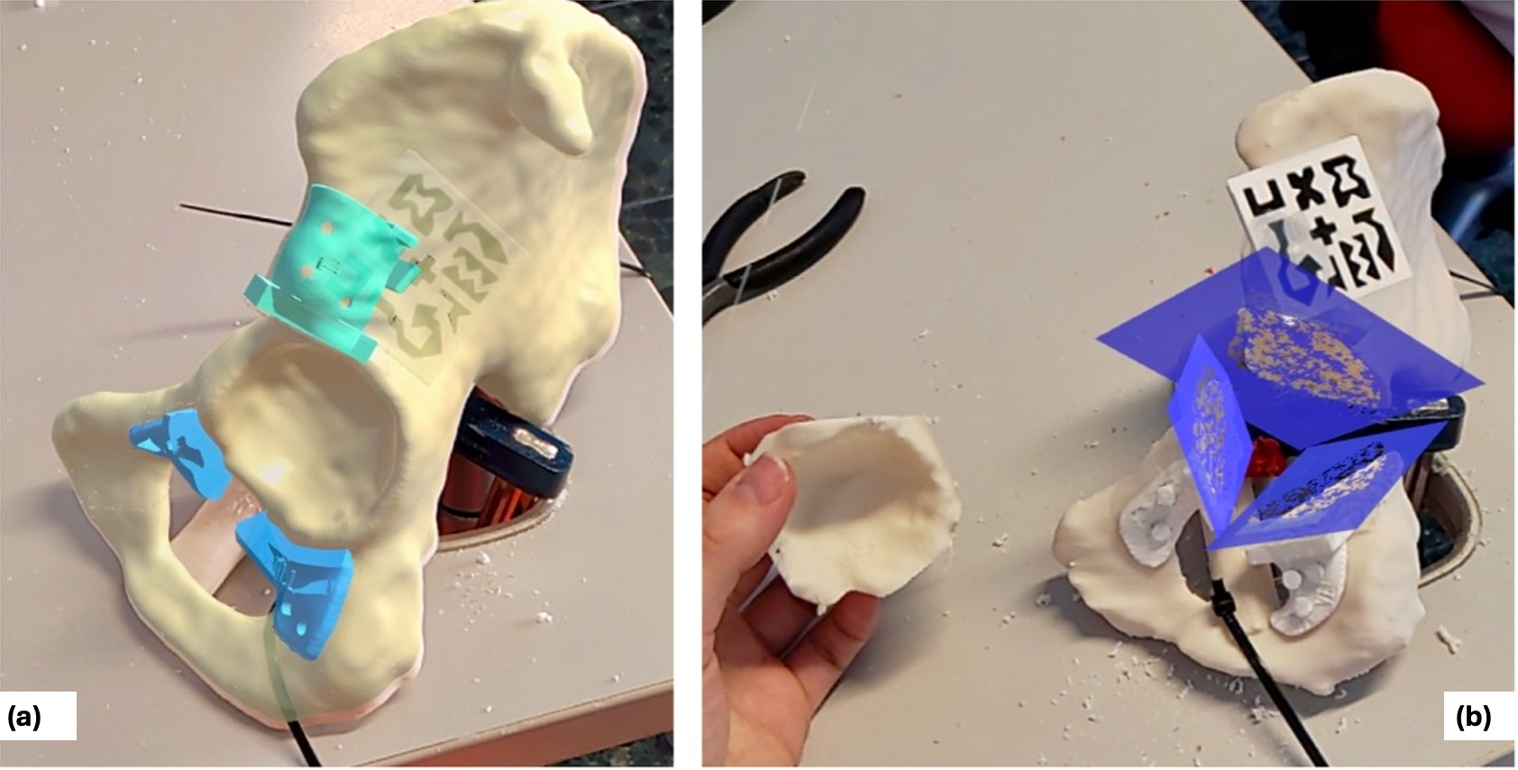 Cancers 17 02260 g005