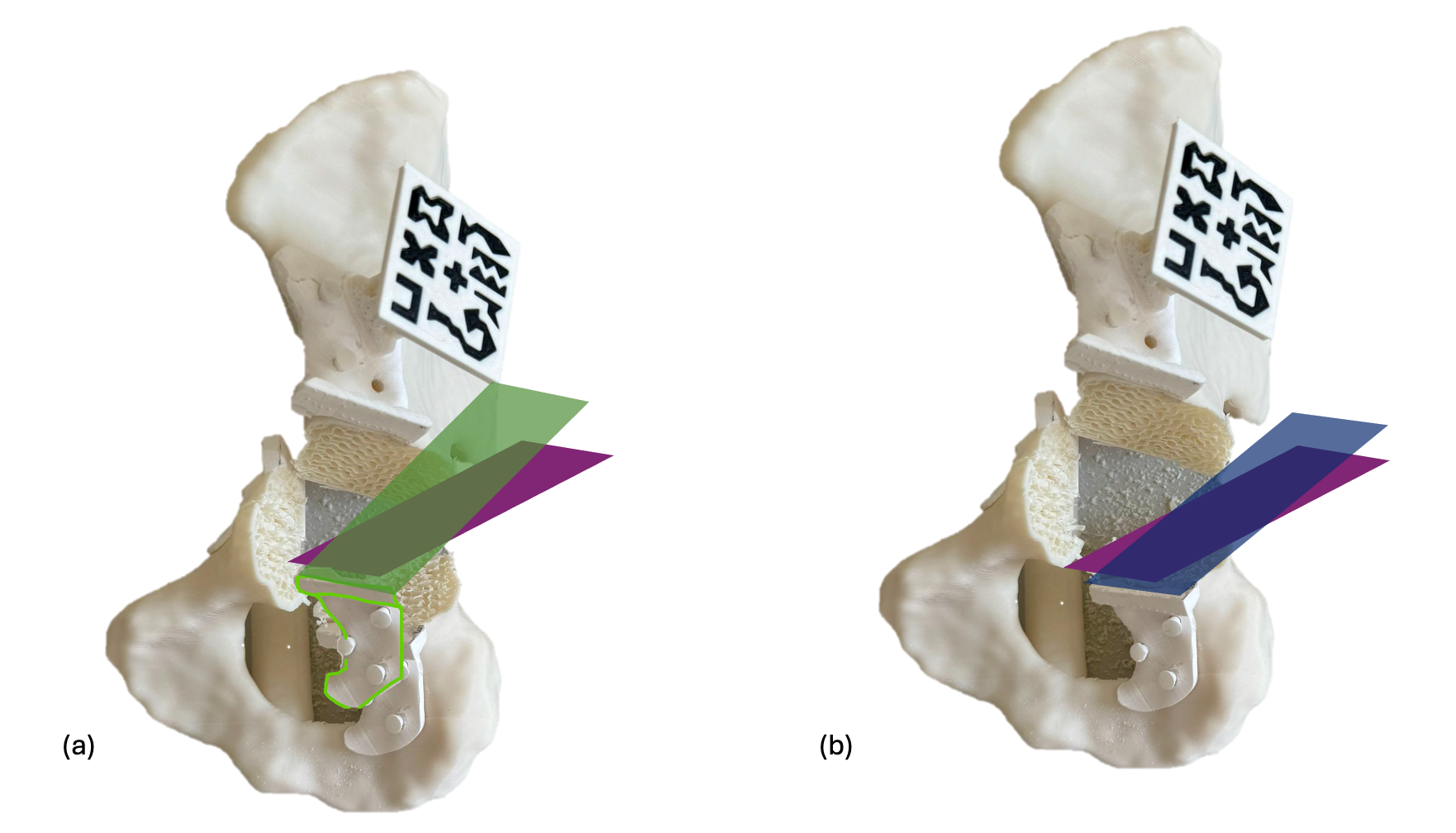 Cancers 17 02260 g007