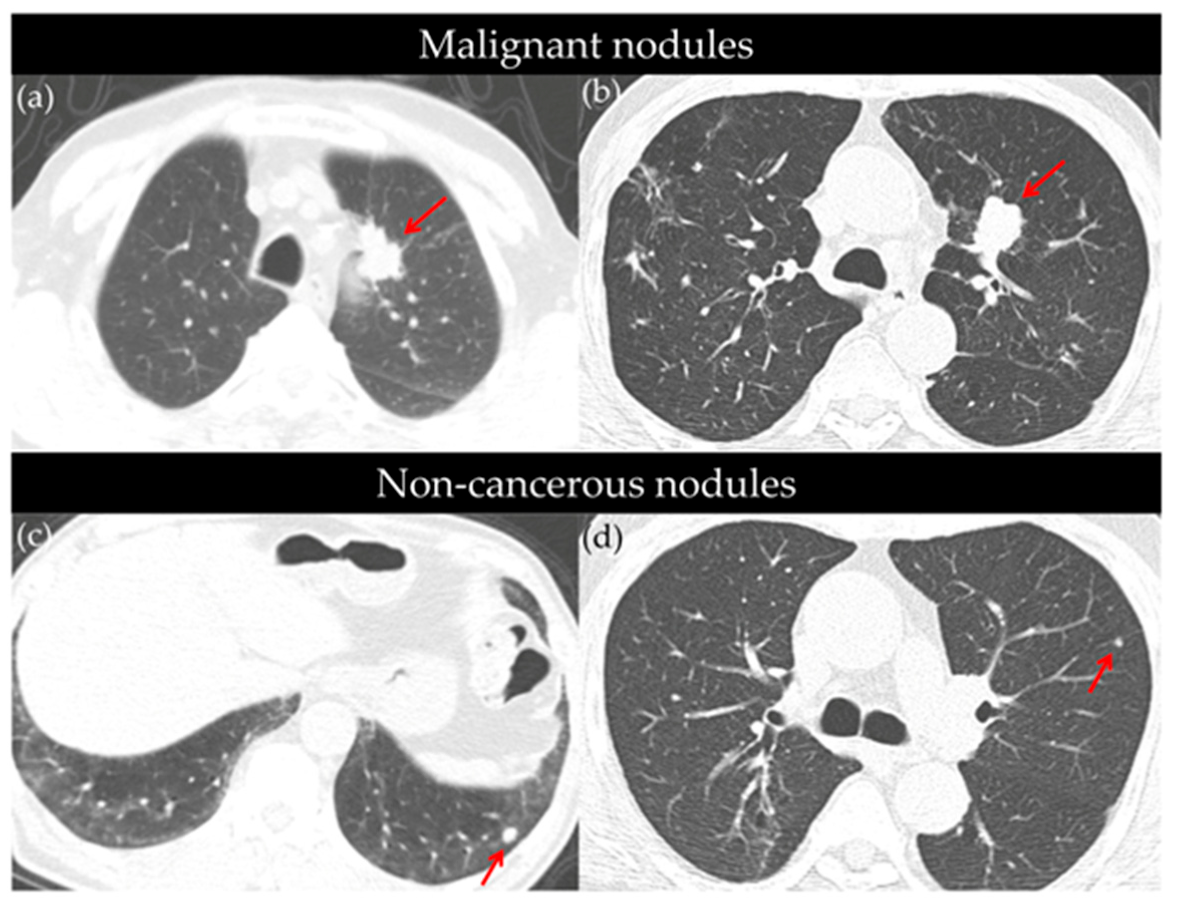 Cancers 17 02318 g002