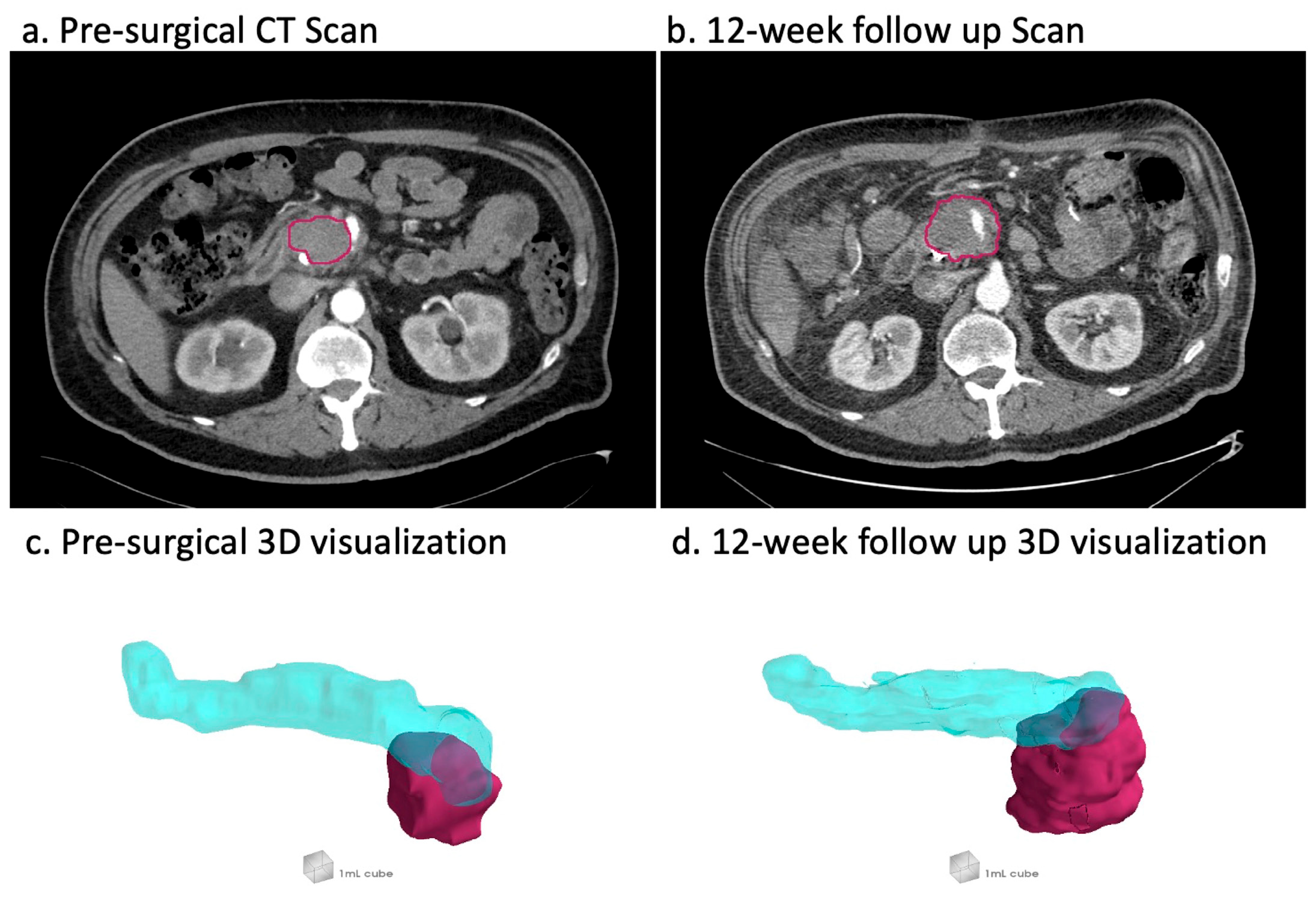 Cancers 17 02338 g001